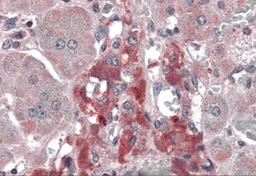 Immunohistochemistry of RIM2 in human adrenal gland tissue with RIM2 antibody at 5 μg/mL.