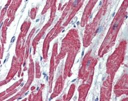 Immunohistochemistry-Paraffin: ALK-1 Antibody [NBP1-30982] - Paraffin-embedded Heart, using  ALK-1   antibody(20 ug/ml).