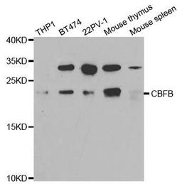 Western blot analysis of extracts of various cell lines using CBFB antibody