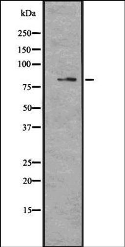 Western blot analysis of U373 cell lysate using MAGD4 antibody