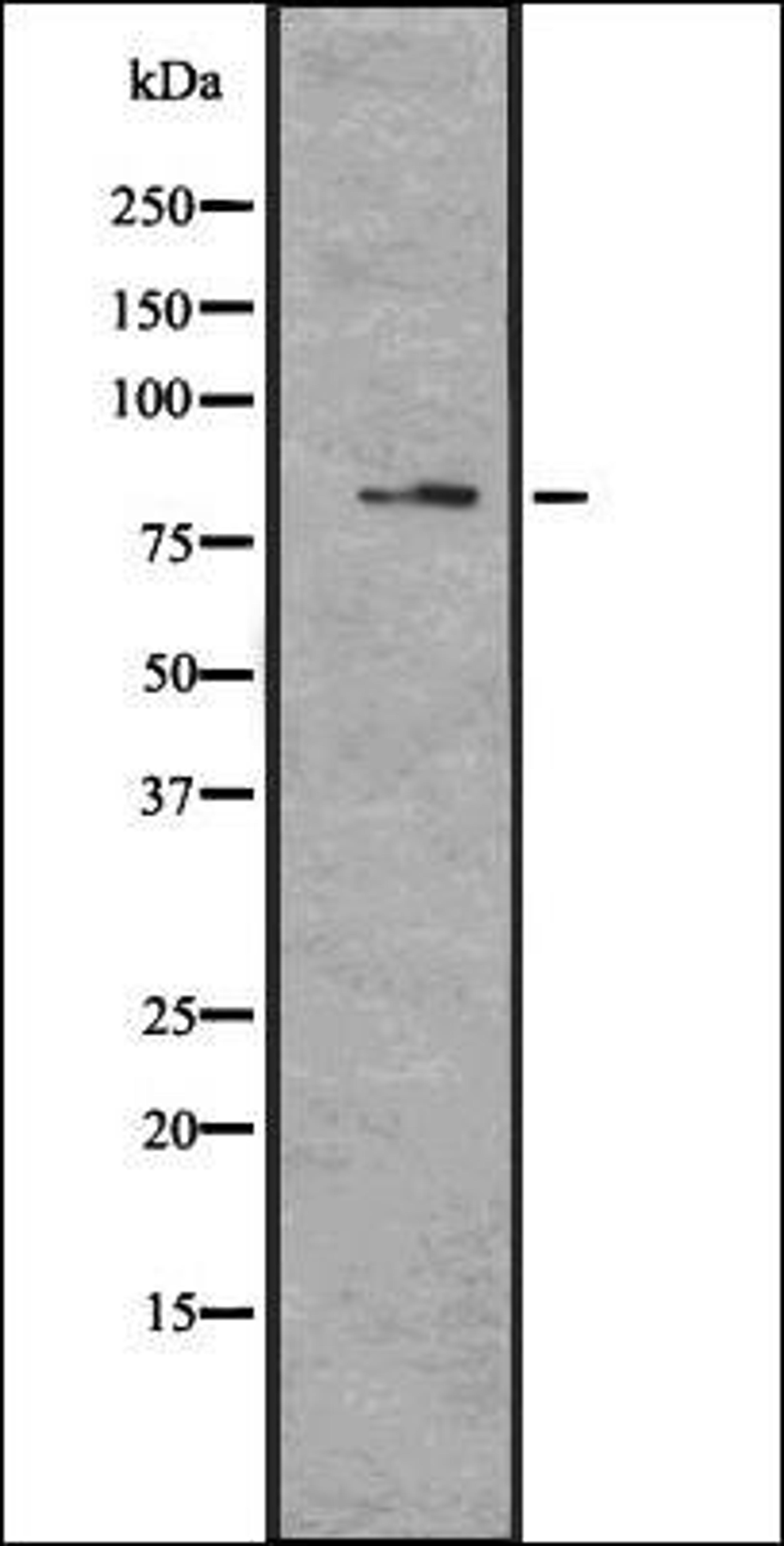 Western blot analysis of U373 cell lysate using MAGD4 antibody