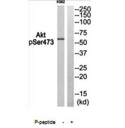 Western blot analysis of extracts from K562 using Akt (phospho-Ser473) antibody