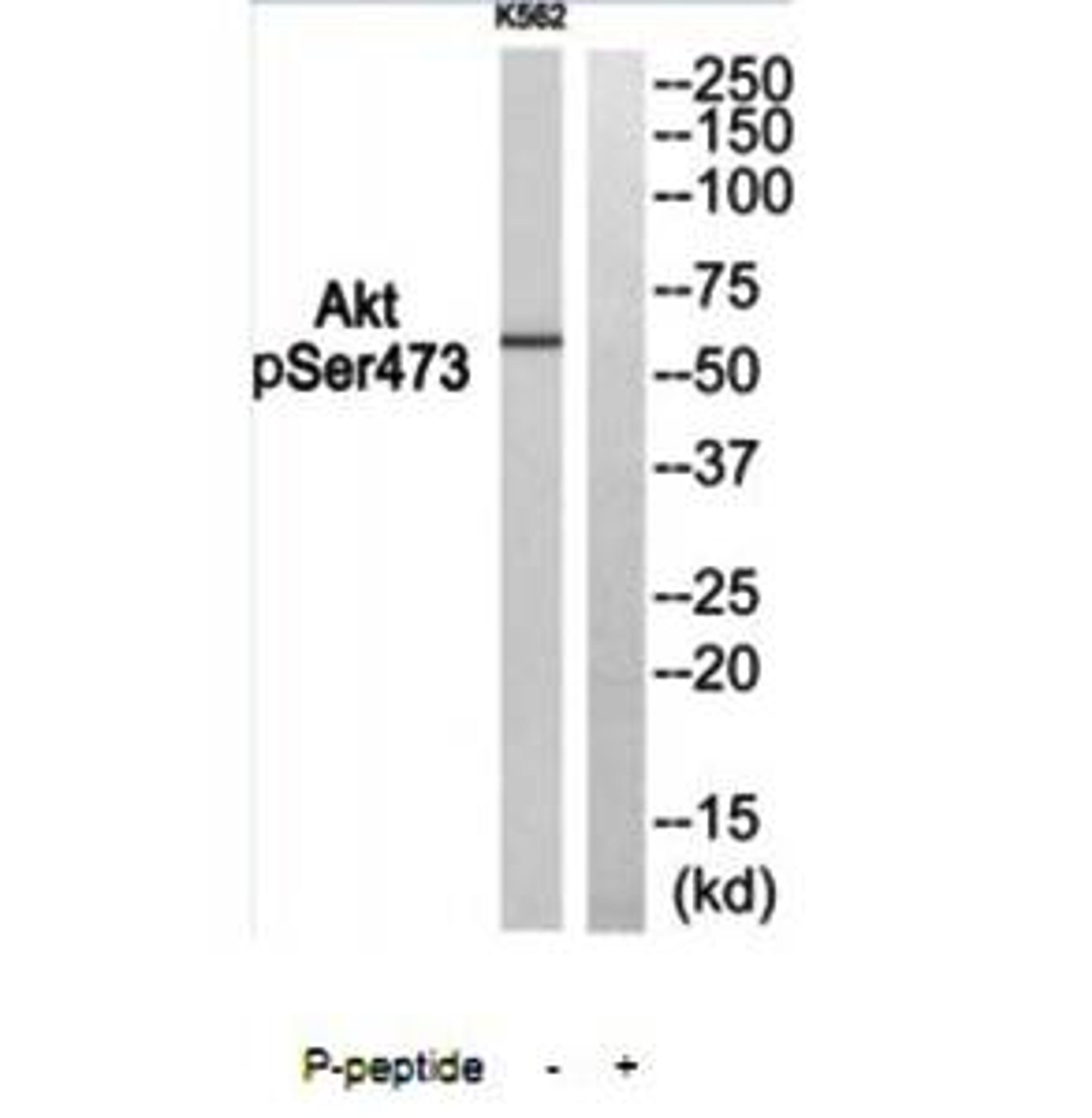 Western blot analysis of extracts from K562 using Akt (phospho-Ser473) antibody