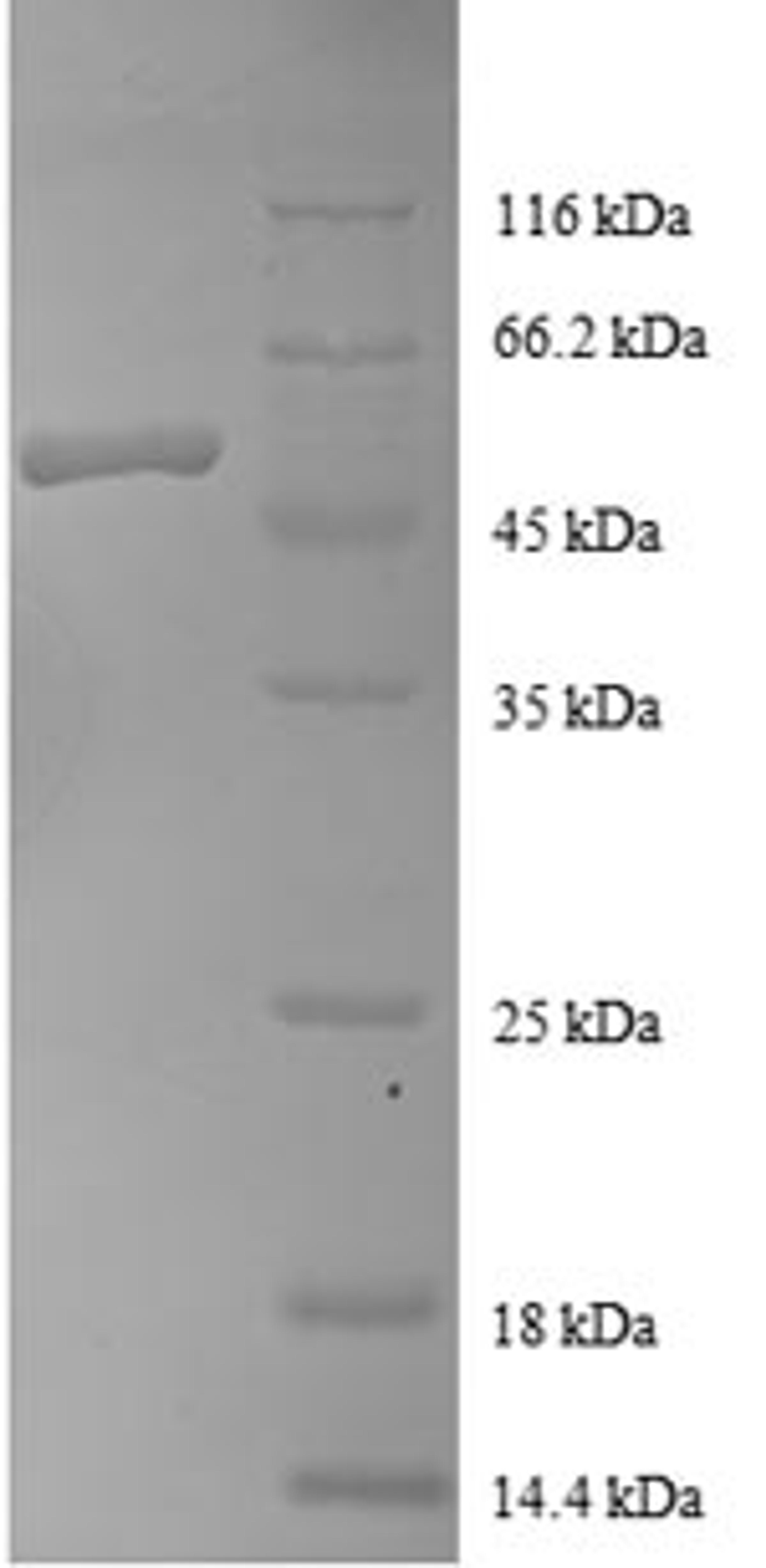 (Tris-Glycine gel) Discontinuous SDS-PAGE (reduced) with 5% enrichment gel and 15% separation gel.