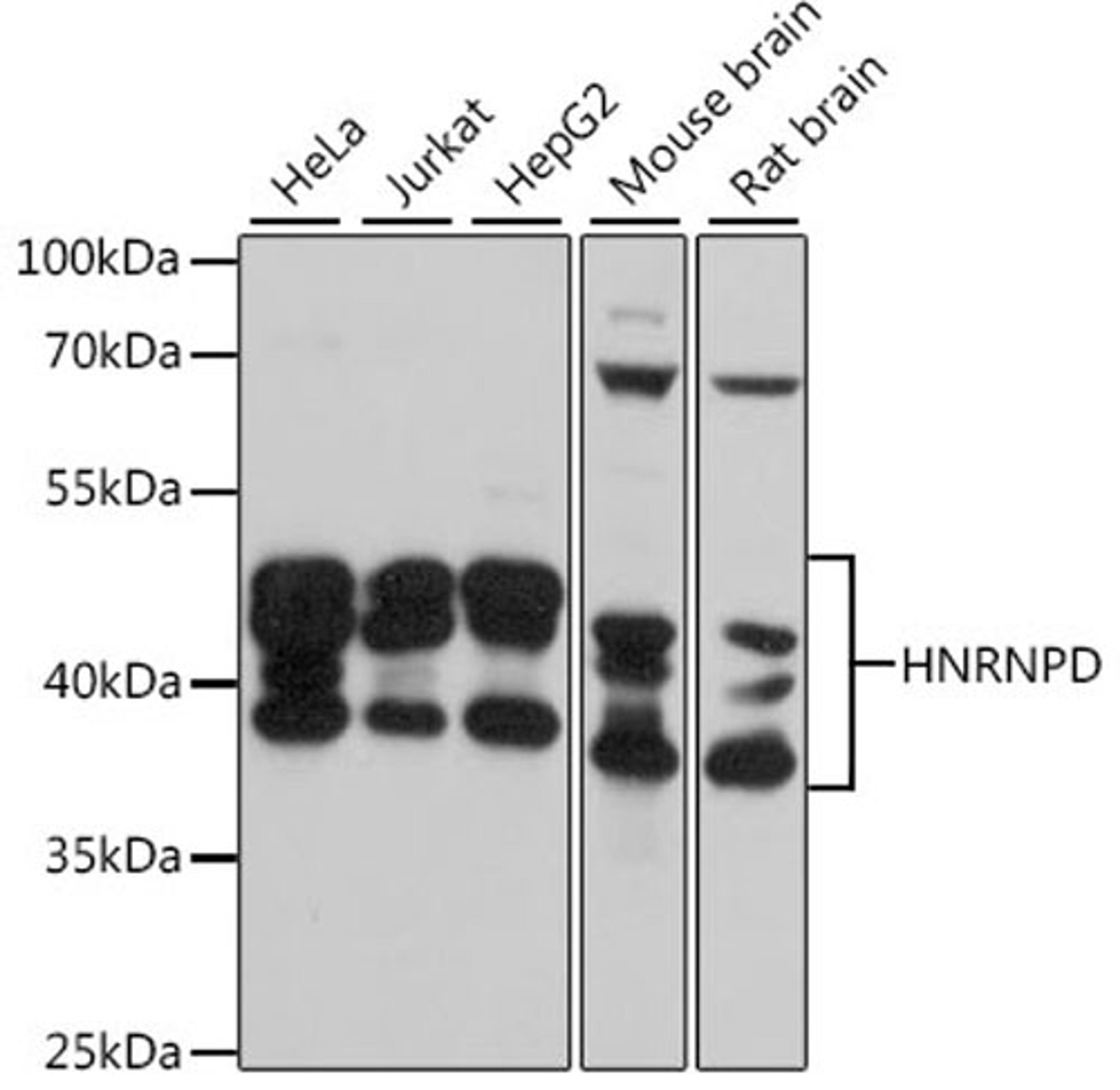 Western blot - HNRNPD antibody (A15679)