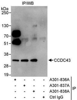 Detection of human CCDC43 by western blot of immunoprecipitates.