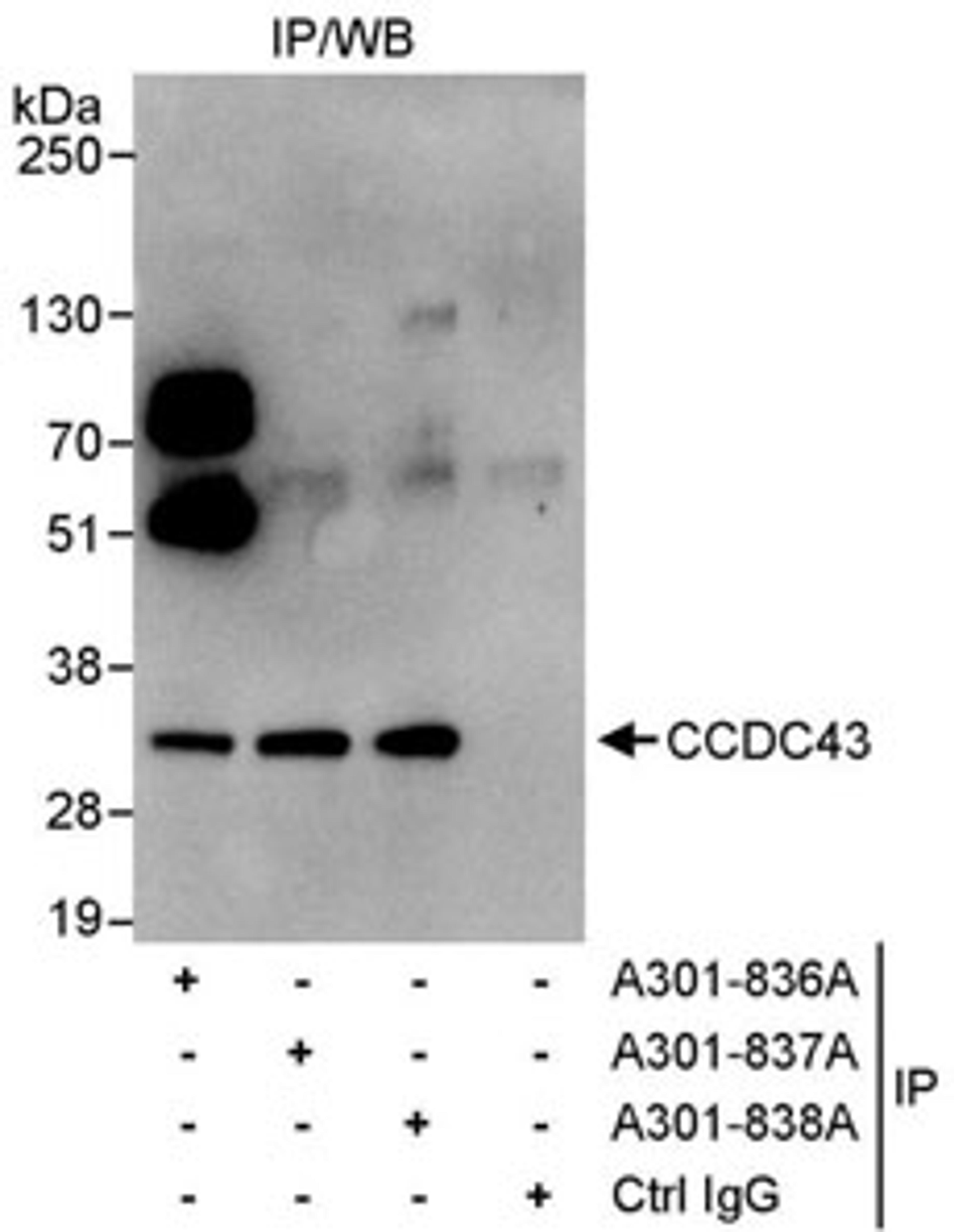 Detection of human CCDC43 by western blot of immunoprecipitates.