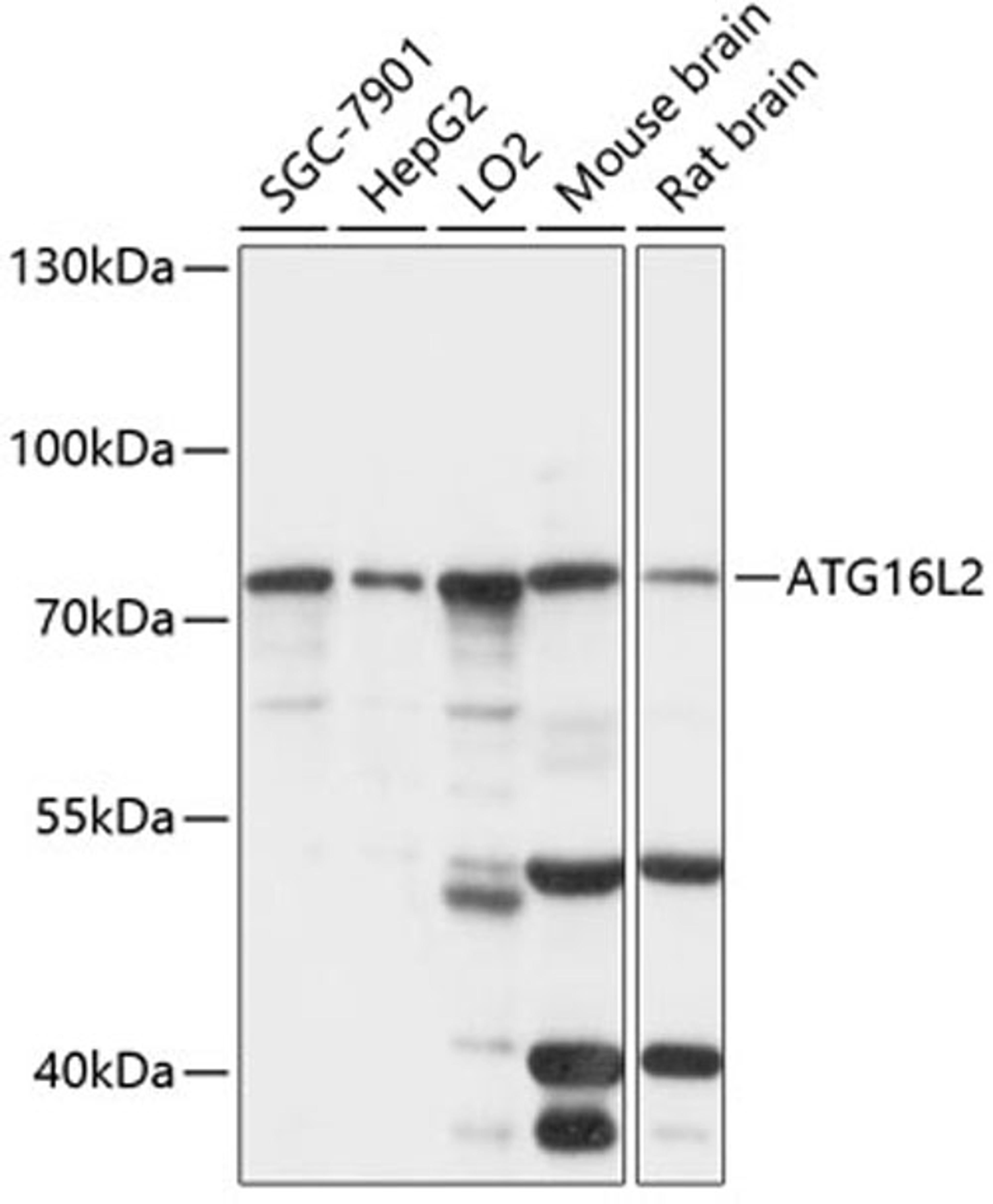 Western blot - ATG16L2 antibody (A14948)