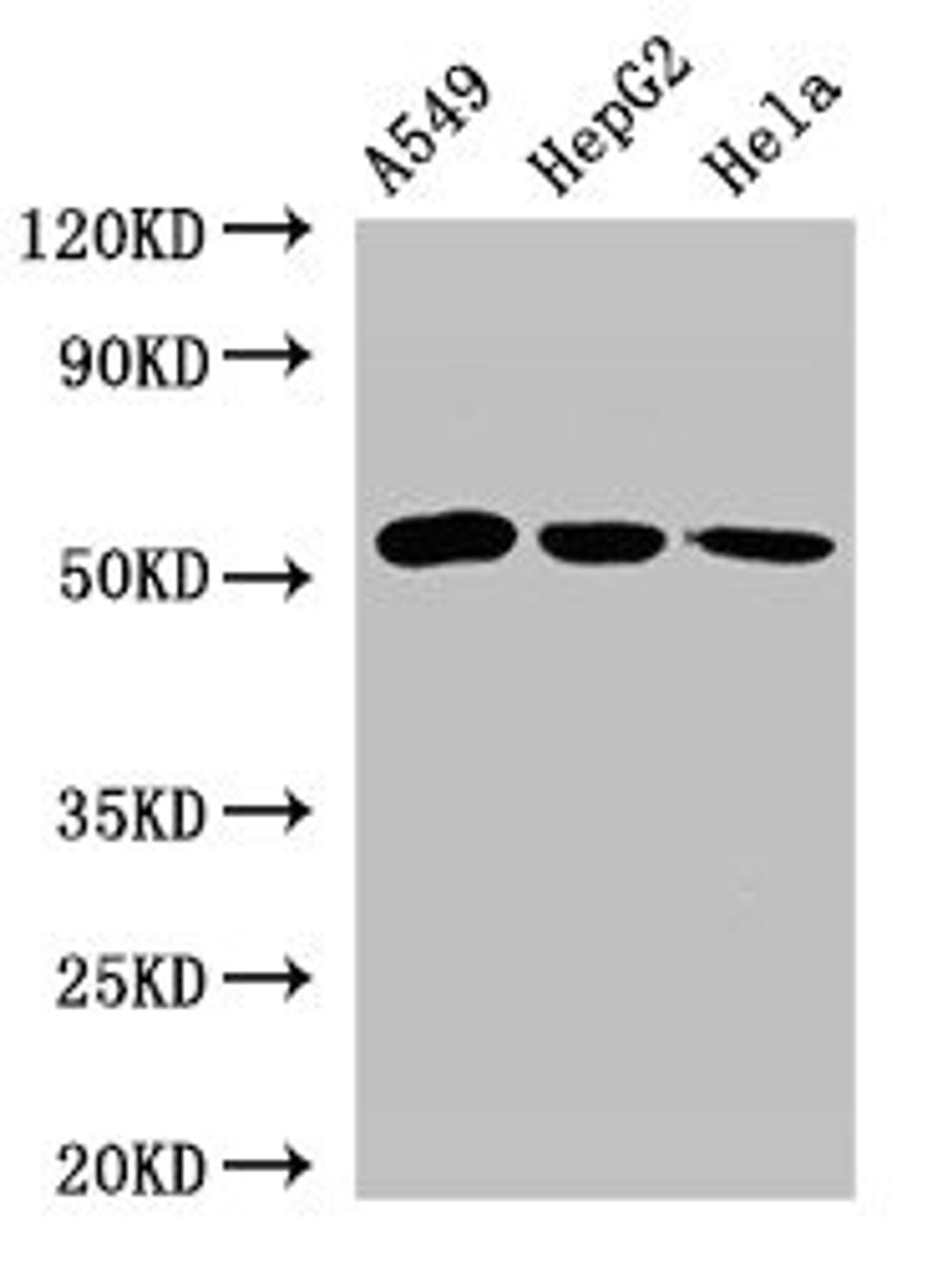 Western Blot. Positive WB detected in: A549 whole cell lysate, HepG2 whole cell lysate, Hela whole cell lysate. All lanes: ONECUT2 antibody at 2.4µg/ml. Secondary. Goat polyclonal to rabbit IgG at 1/50000 dilution. Predicted band size: 55 kDa. Observed band size: 55 kDa