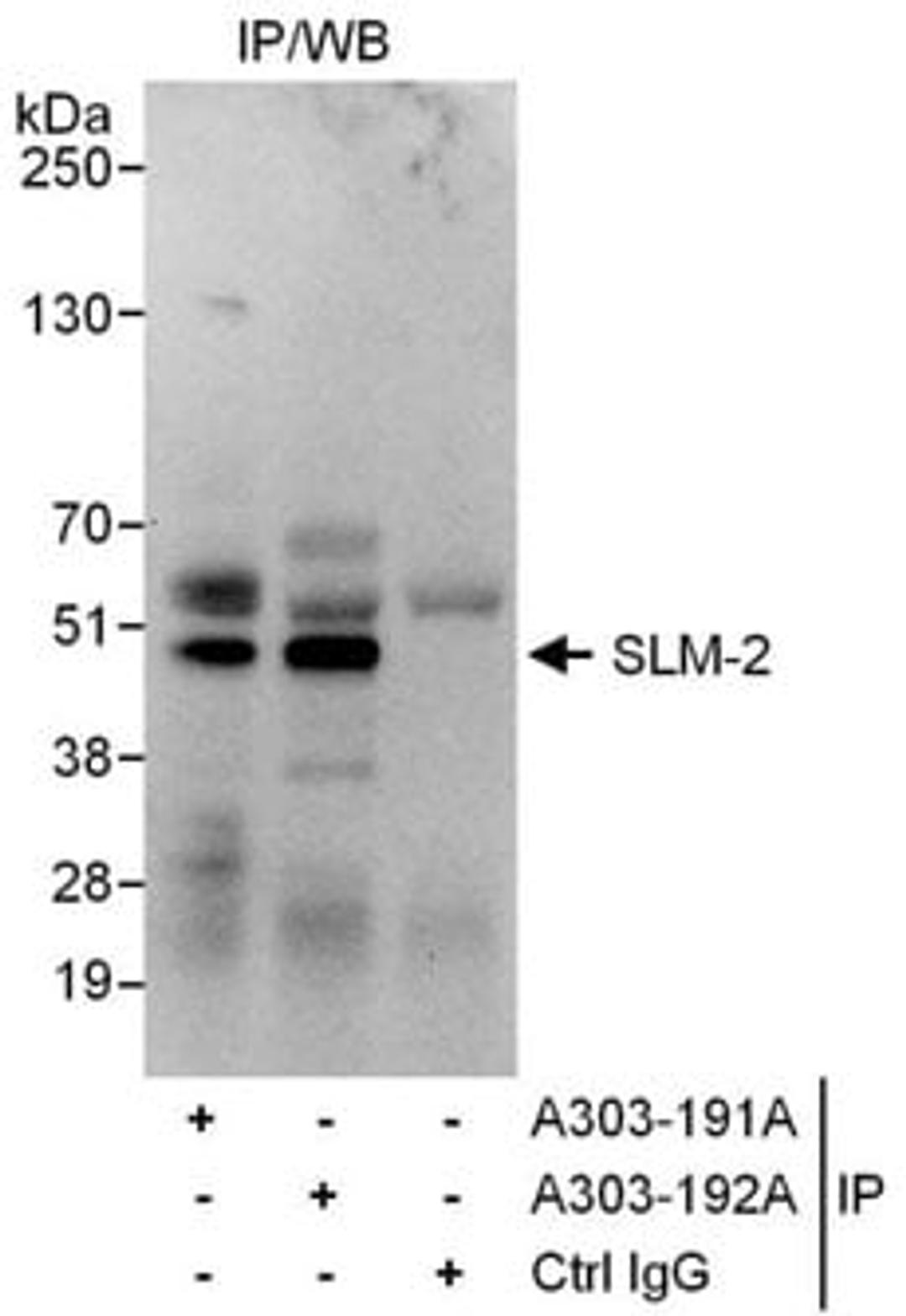 Detection of human SLM-2 by western blot of immunoprecipitates.