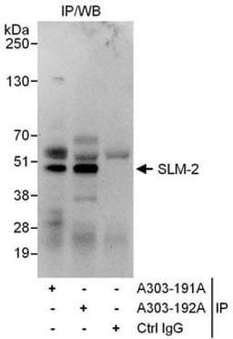 Detection of human SLM-2 by western blot of immunoprecipitates.