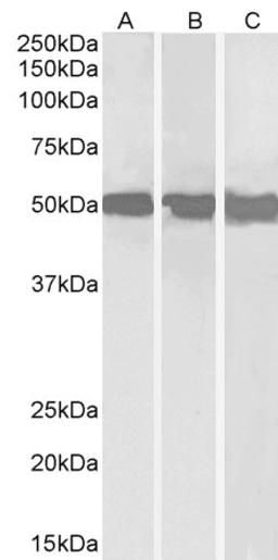 45-471 (0.3ug/ml) staining of Daudi (A), Jurkat (B) and HepG2 (C) lysates (35ug protein in RIPA buffer). Primary incubation was 1 hour. Detected by chemiluminescence.