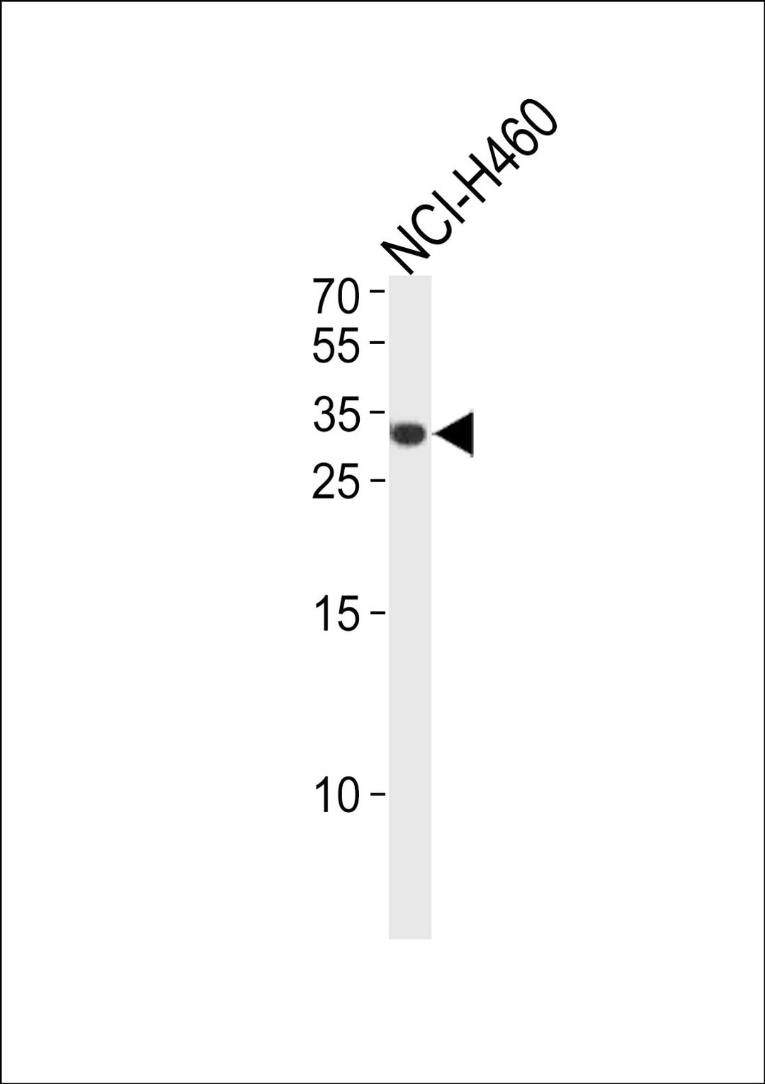 Western blot analysis in NCI-H460 cell line lysates (35ug/lane).