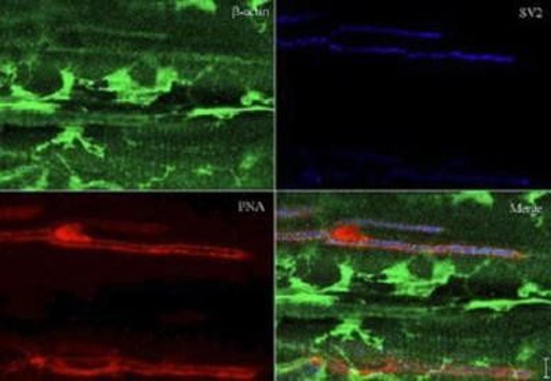 Immunohistochemistry: beta-Actin Antibody [NB600-505] - staining y at 1:200 shows detection of actin at the neuromuscular juntion of rana pipiens tissue. Formalin fixed paraffin embedded sections.