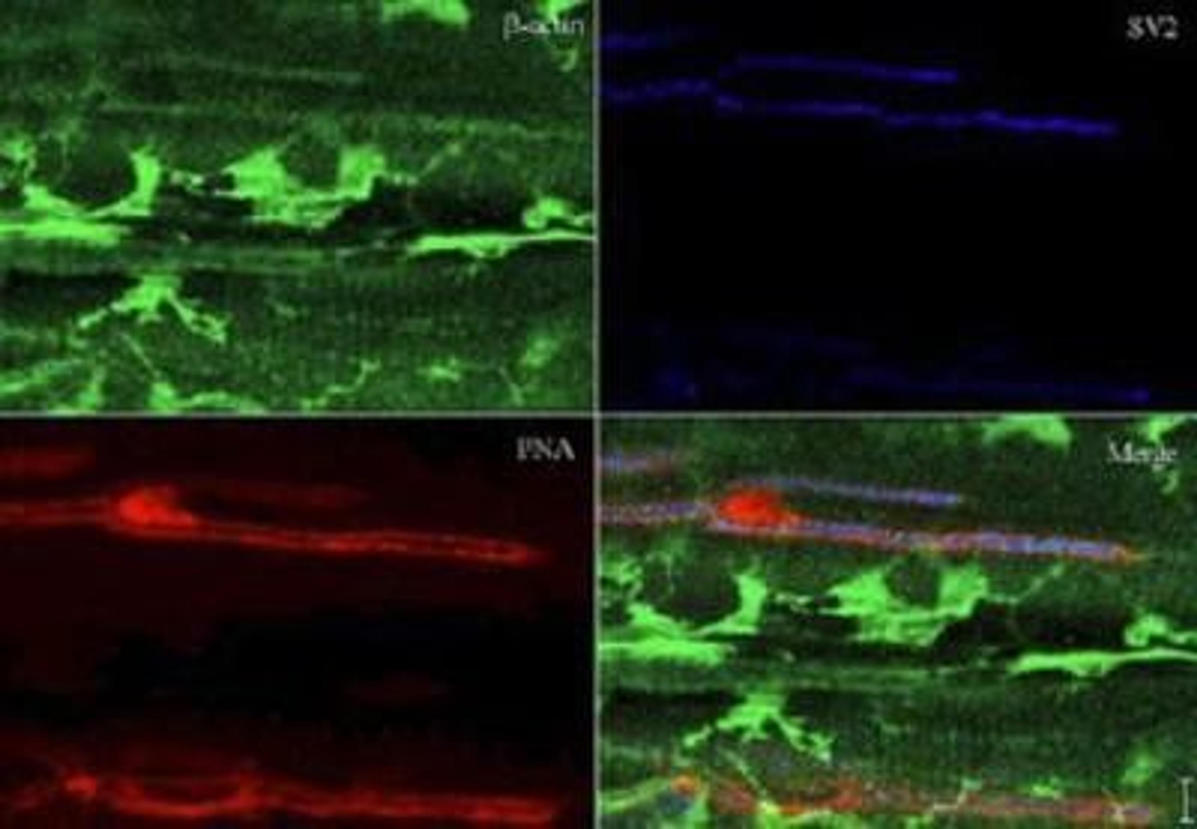 Immunohistochemistry: beta-Actin Antibody [NB600-505] - staining y at 1:200 shows detection of actin at the neuromuscular juntion of rana pipiens tissue. Formalin fixed paraffin embedded sections.