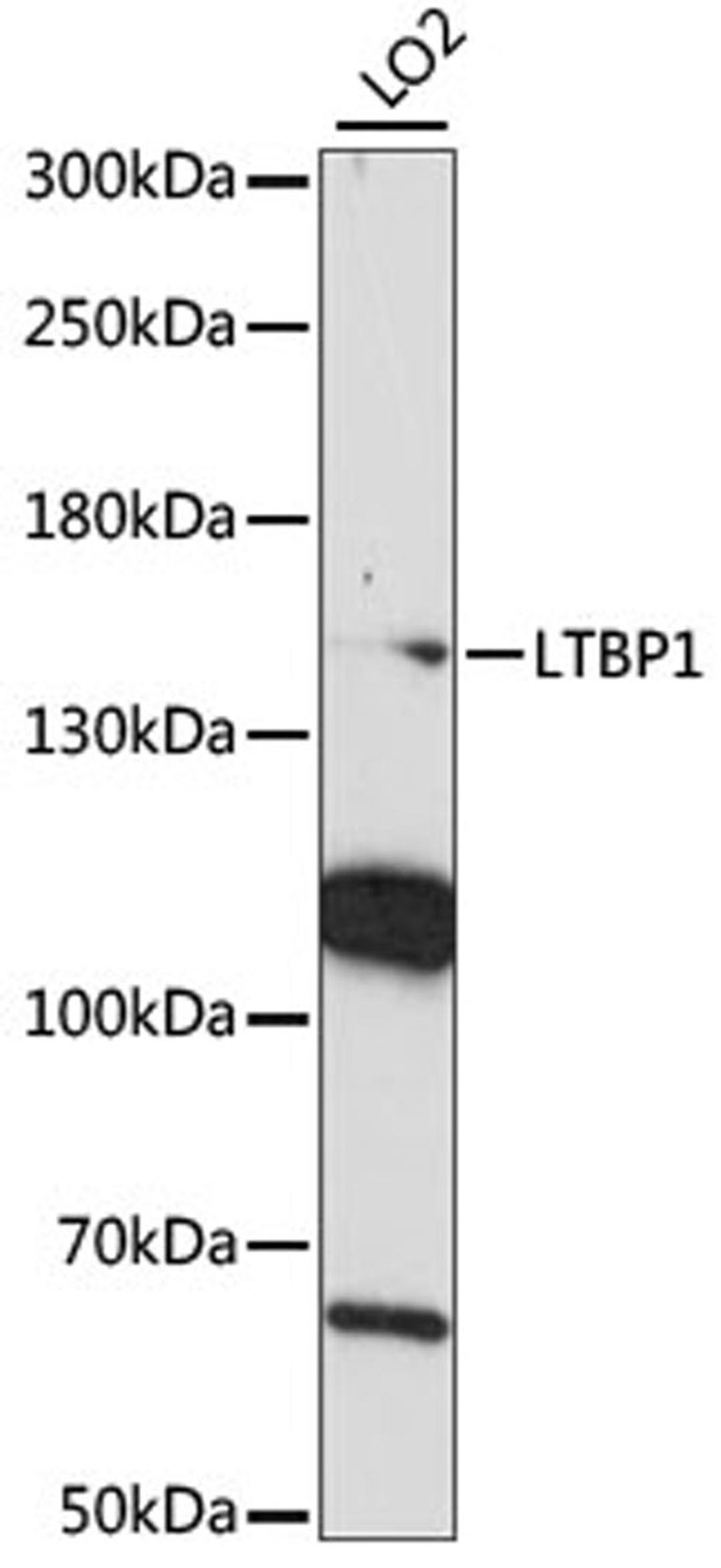 Western blot - LTBP1 antibody (A15287)