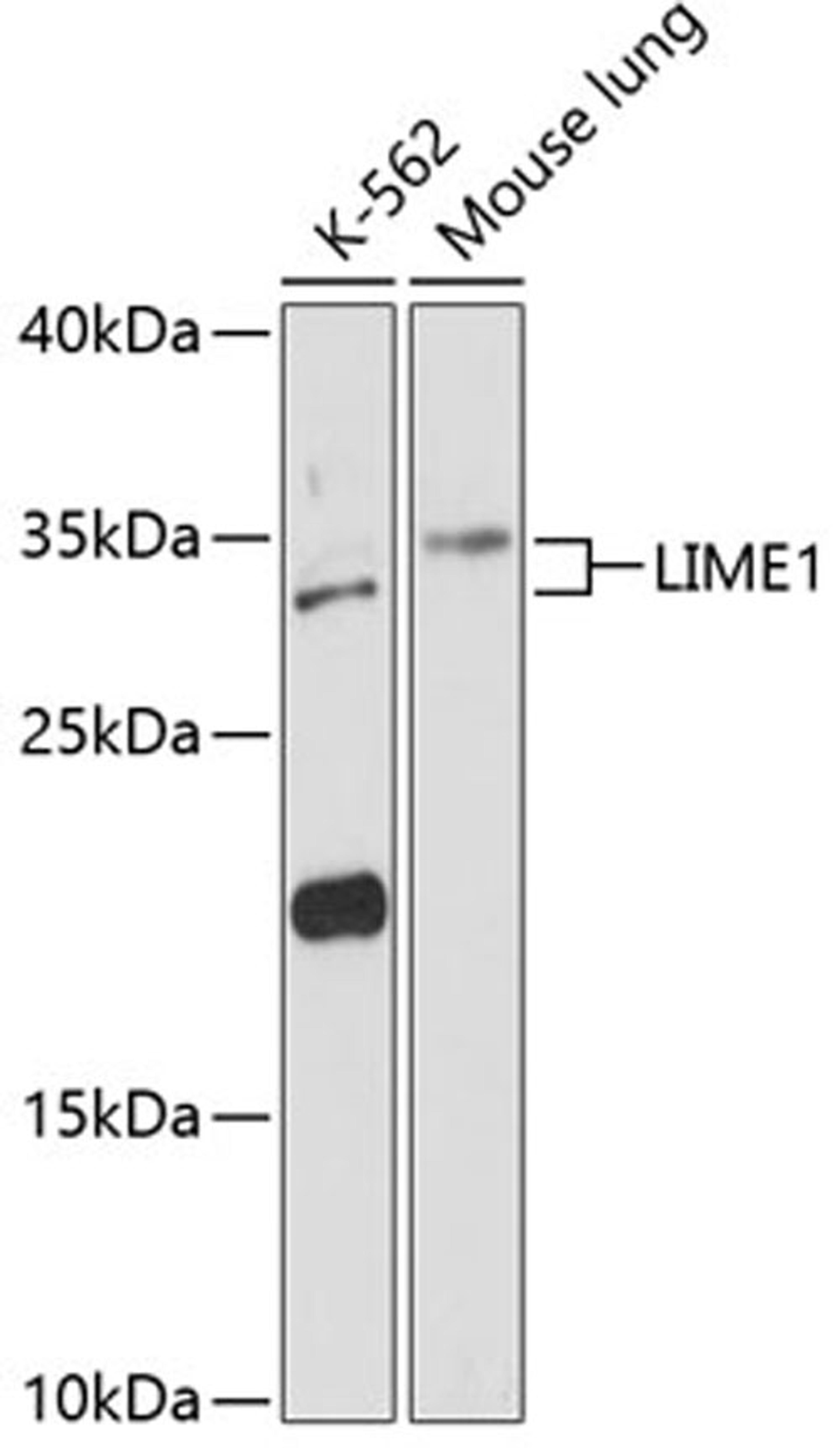 Western blot - LIME1 antibody (A13719)