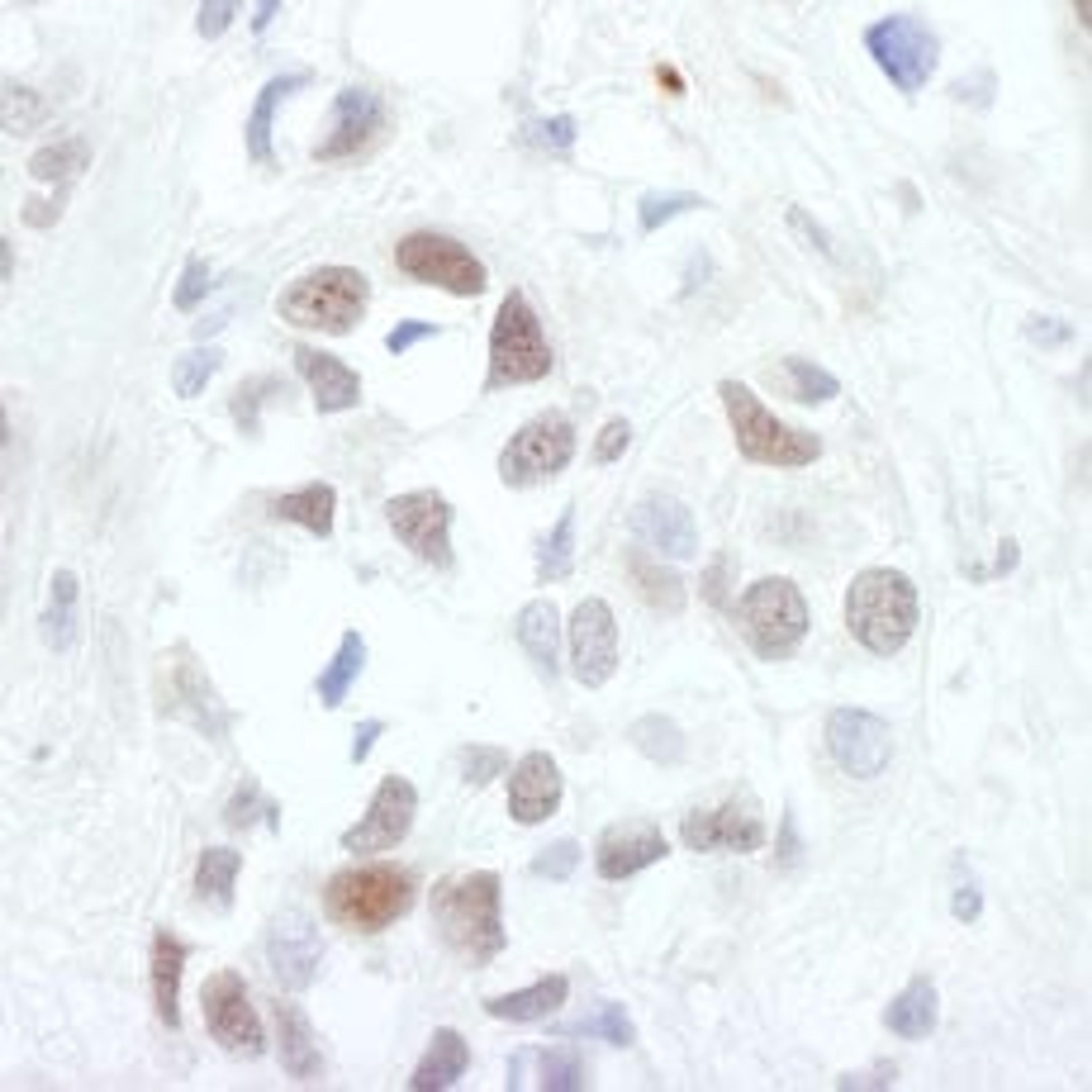 Detection of human c-Jun by immunohistochemistry.