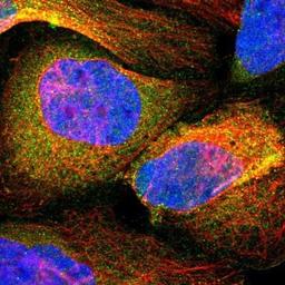 Immunocytochemistry/Immunofluorescence: STAT6 Antibody [NBP1-85345] - Staining of human cell line U-2 OS shows positivity in nucleus but not nucleoli & cytoplasm.