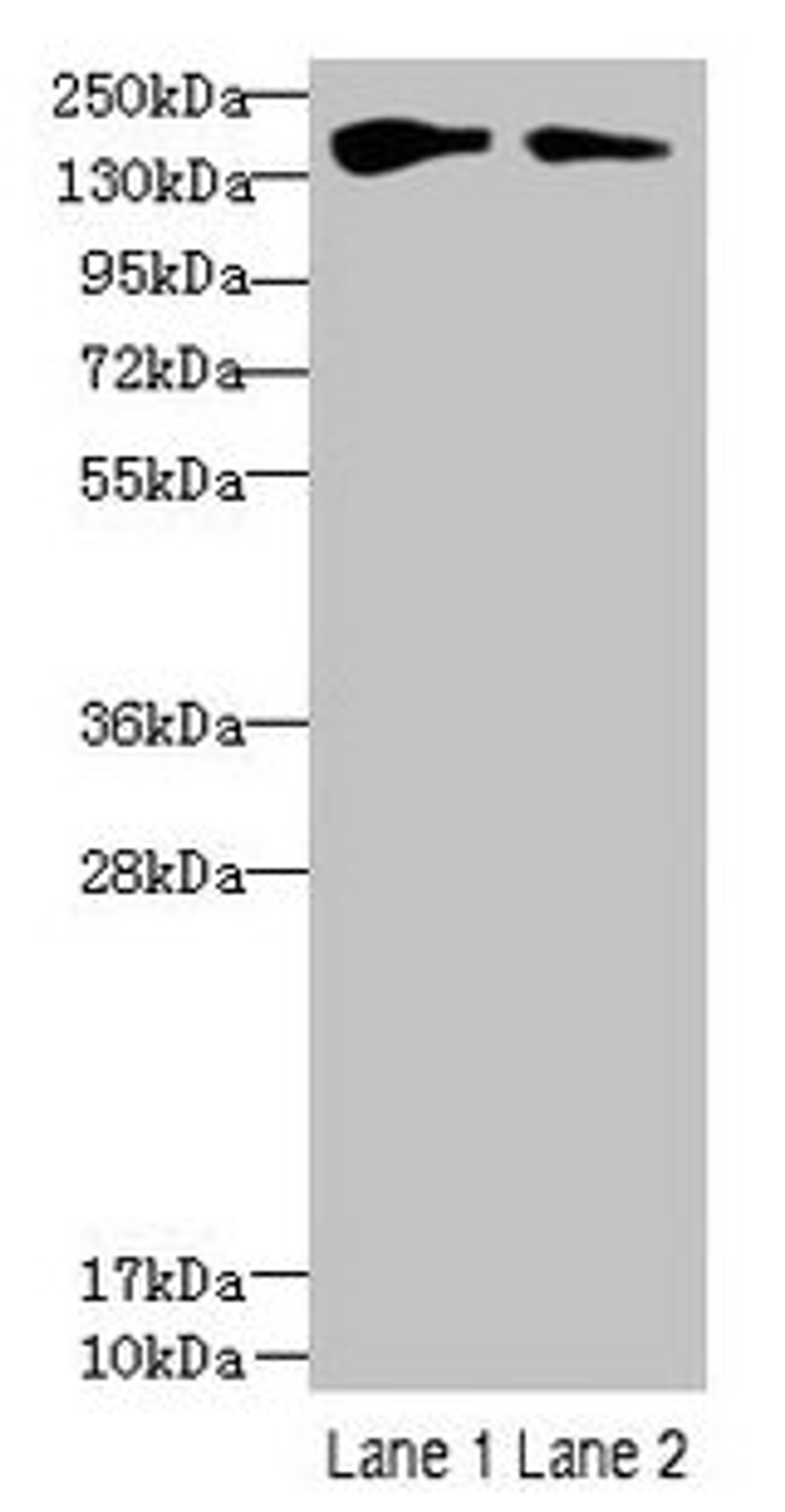Western blot. All lanes: FYCO1 antibody at 2.5µg/ml. Lane 1: HepG2 whole cell lysate. Lane 2: Mouse liver tissue. Secondary. Goat polyclonal to rabbit IgG at 1/10000 dilution. Predicted band size: 167, 44, 169 kDa. Observed band size: 167 kDa