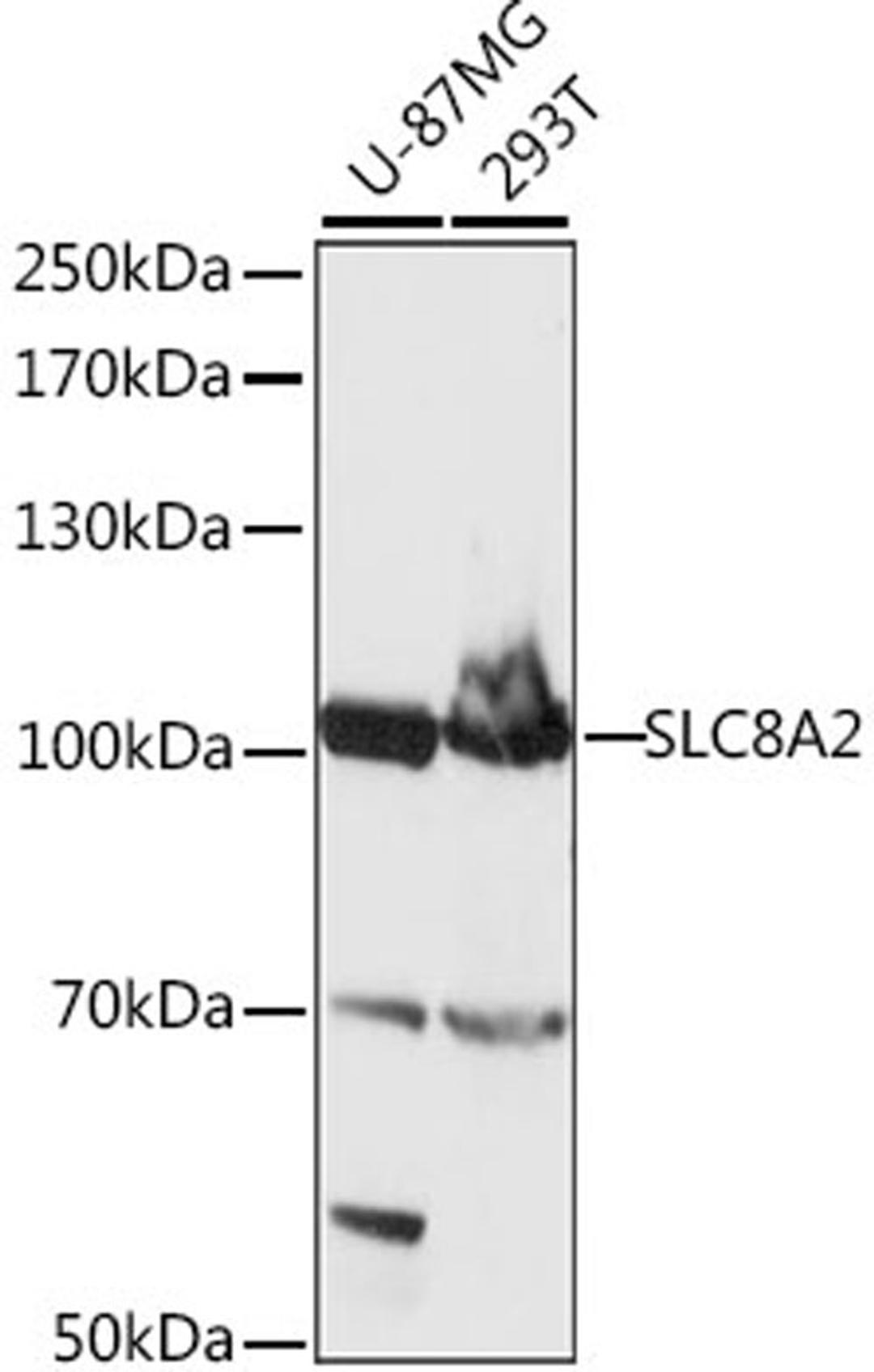 Western blot - SLC8A2 antibody (A15723)