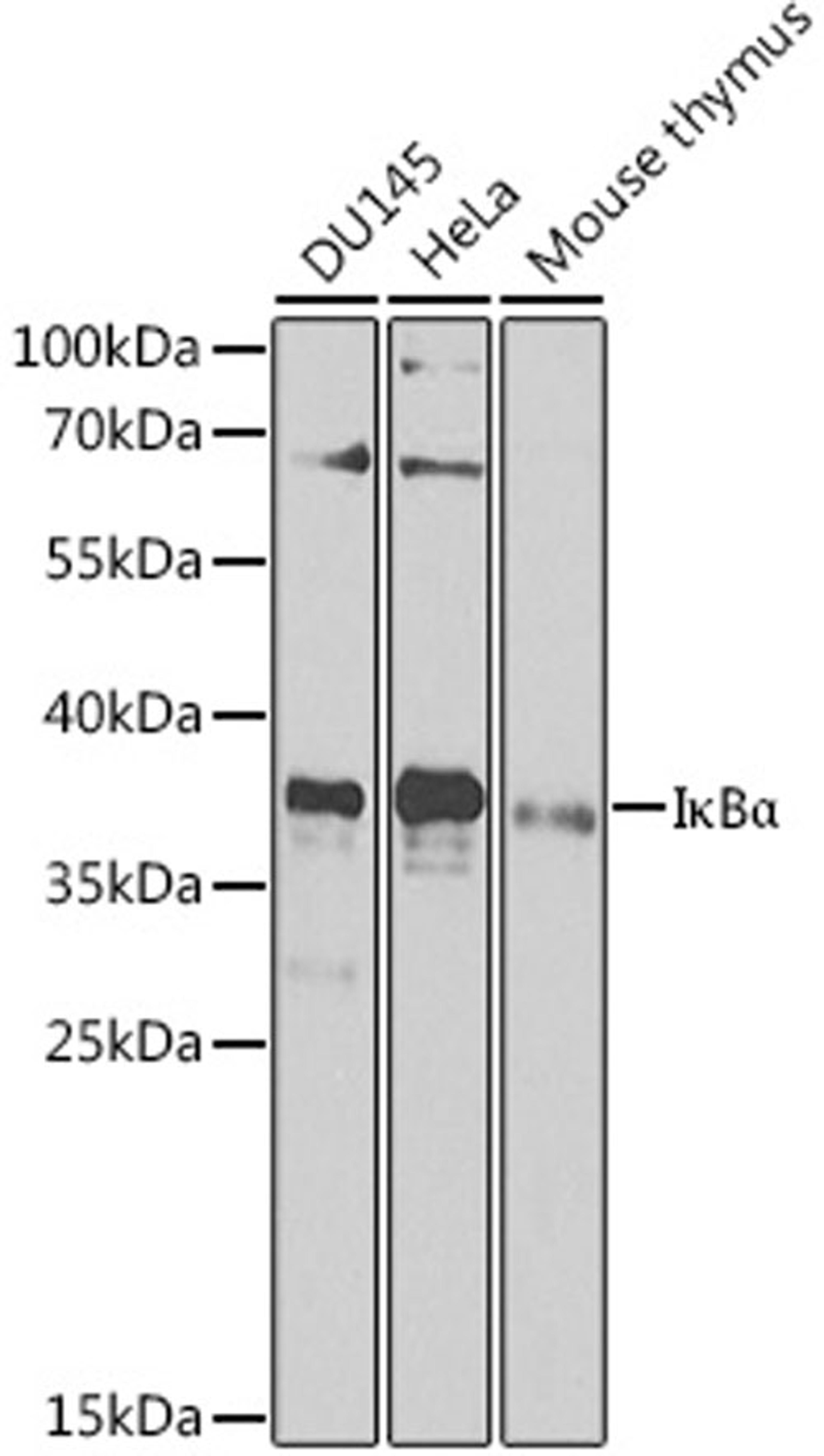 Western blot - I?Ba antibody (A11474)