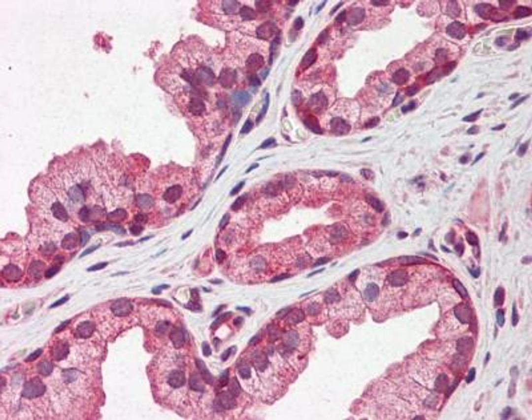 Immunohistochemistry-Paraffin: Pentraxin 3/TSG-14 Antibody [NBP1-58990] - Human prostate cell lysate tissue at an antibody concentration of 5 ug/ml.