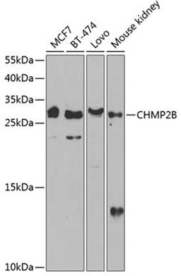 Western blot - CHMP2B antibody (A13410)