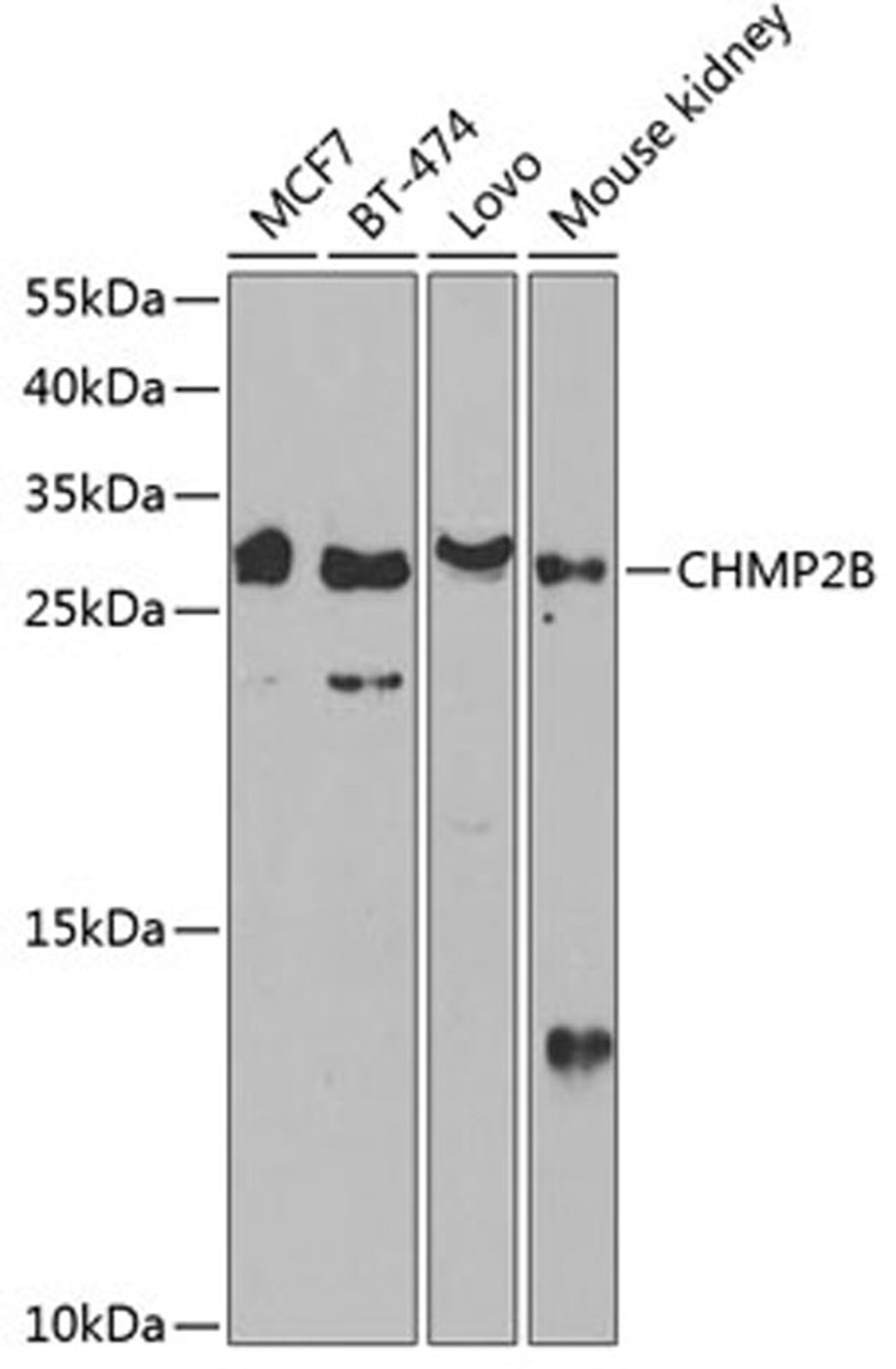 Western blot - CHMP2B antibody (A13410)