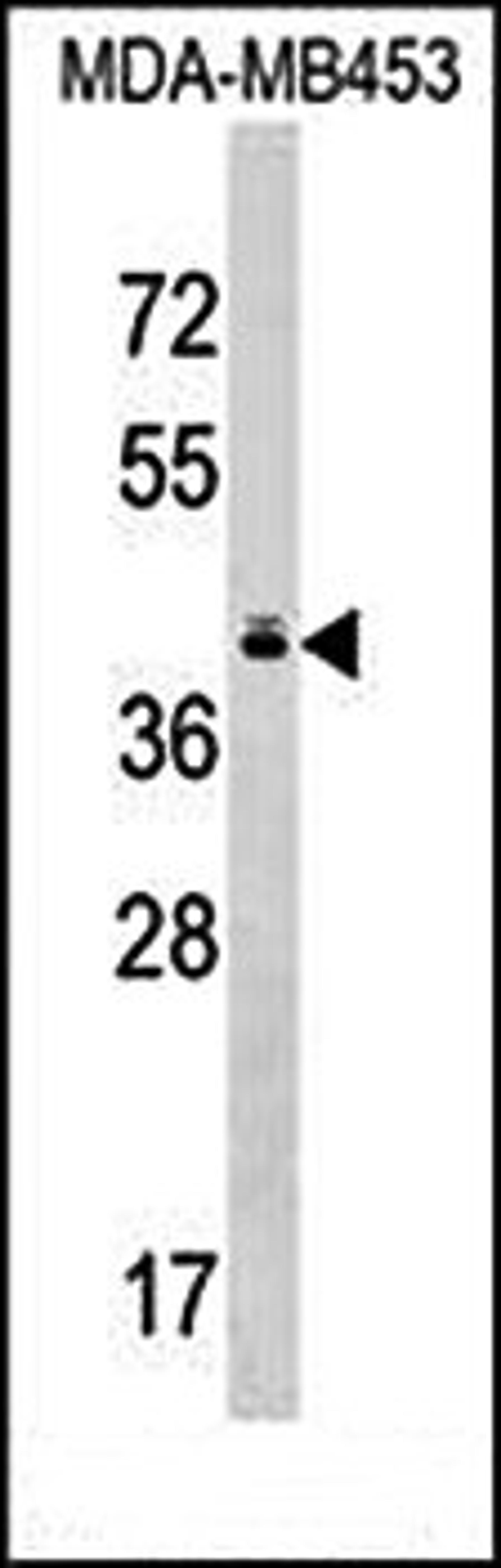 Western blot analysis of MDA-MB453 cell line lysates (35ug/lane) using TAS2R10 (Center) antibody