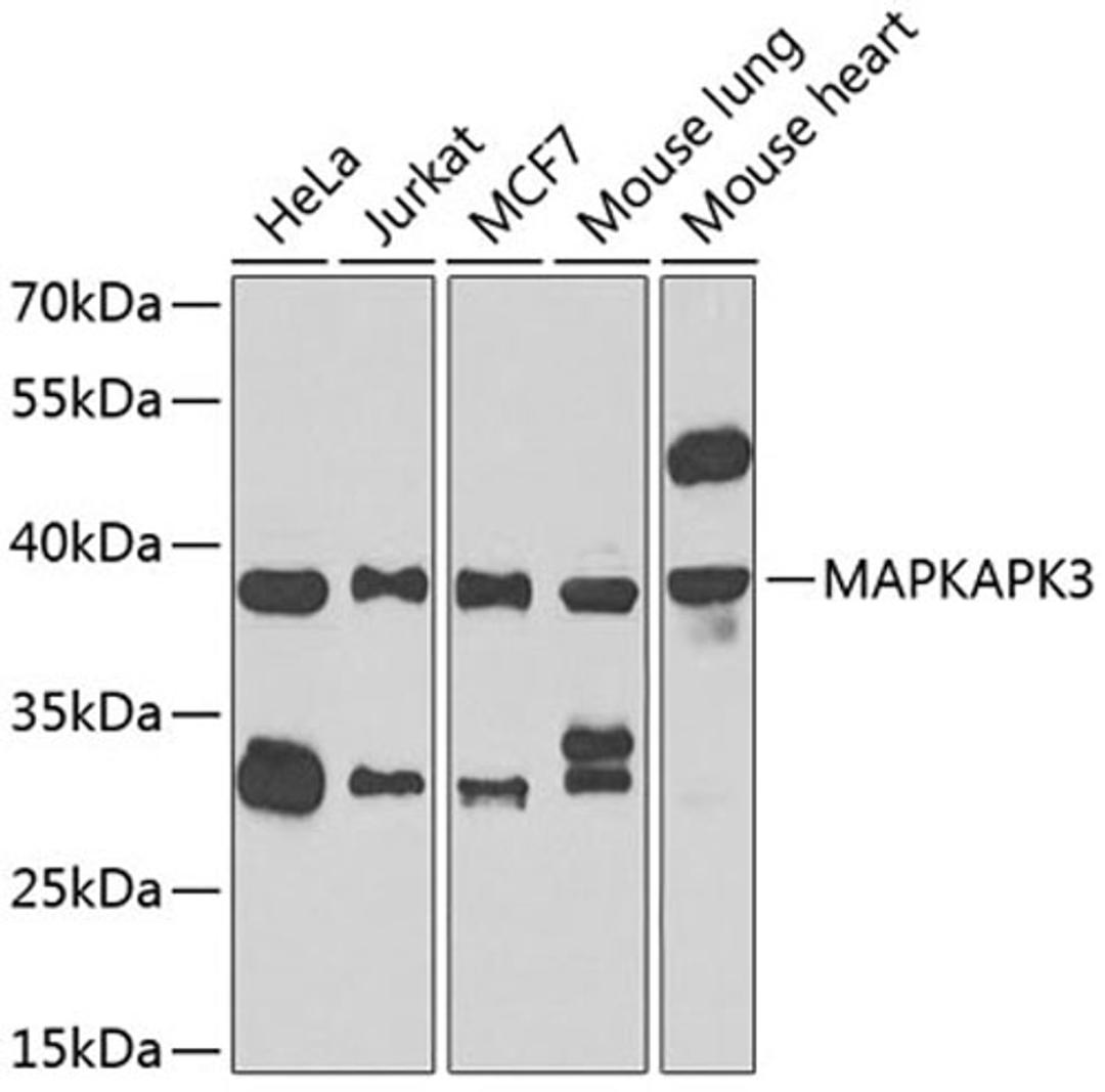 Western blot - MAPKAPK3 antibody (A7572)