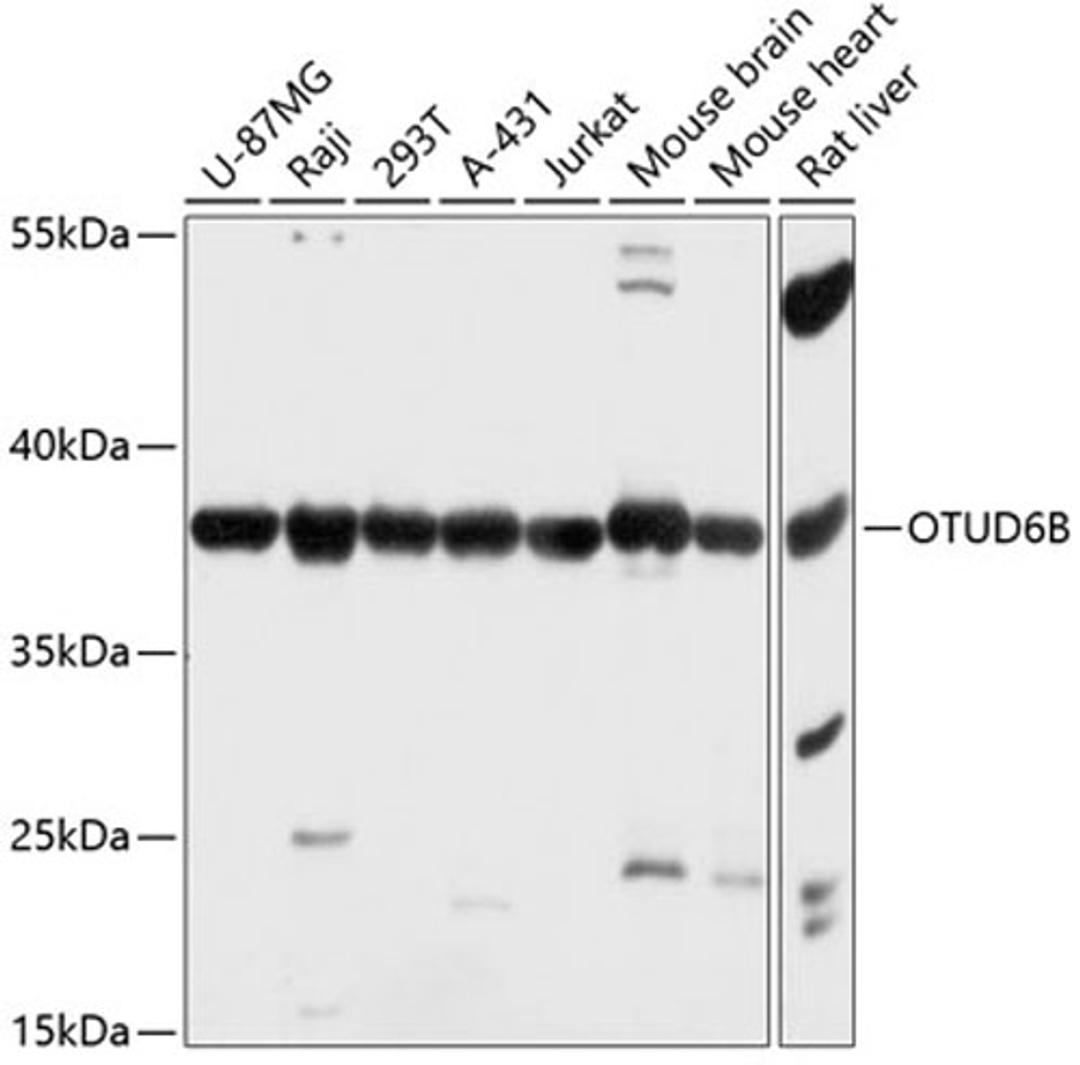 Western blot - OTUD6B antibody (A14511)