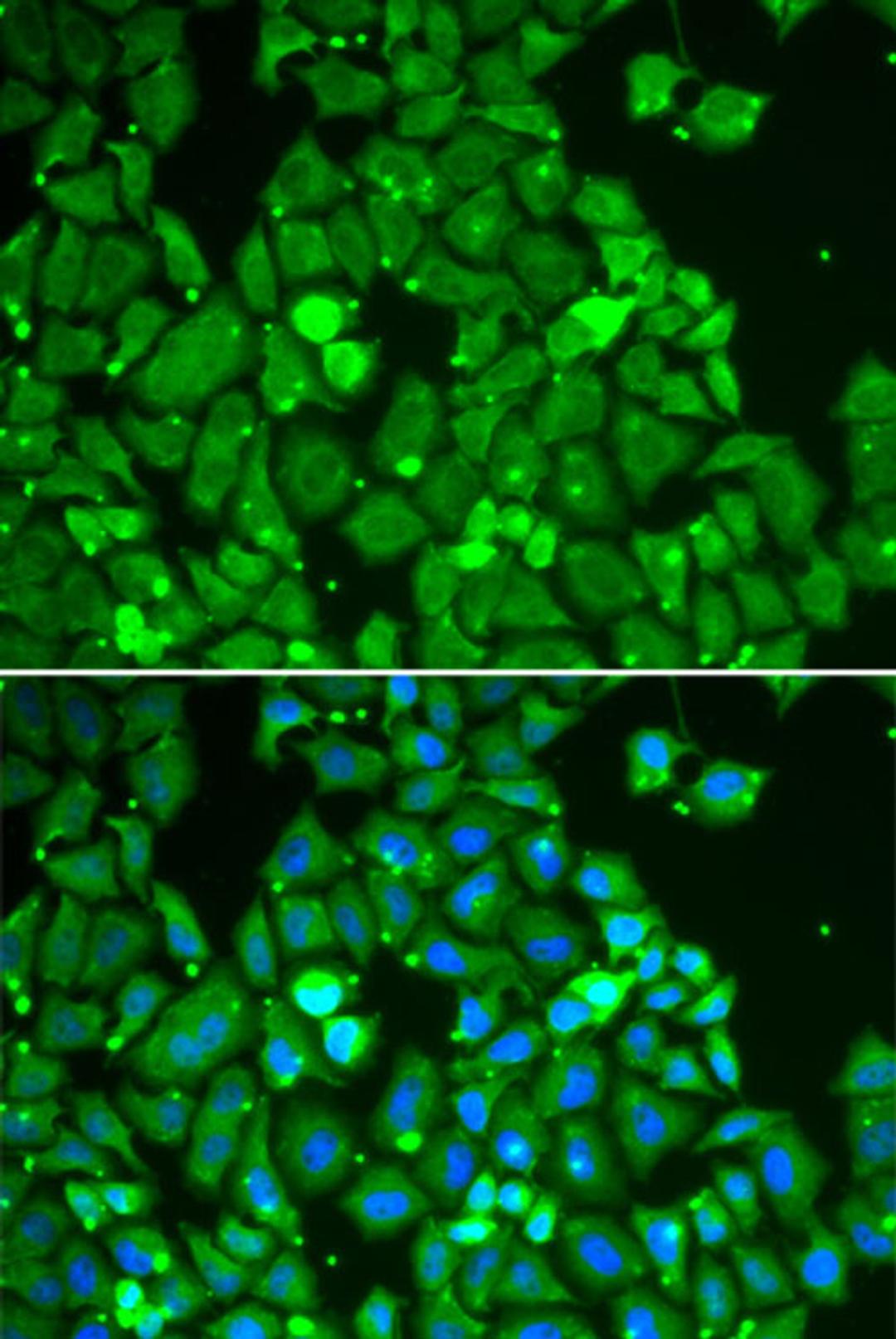 Immunofluorescence - STAT1 antibody (A12330)