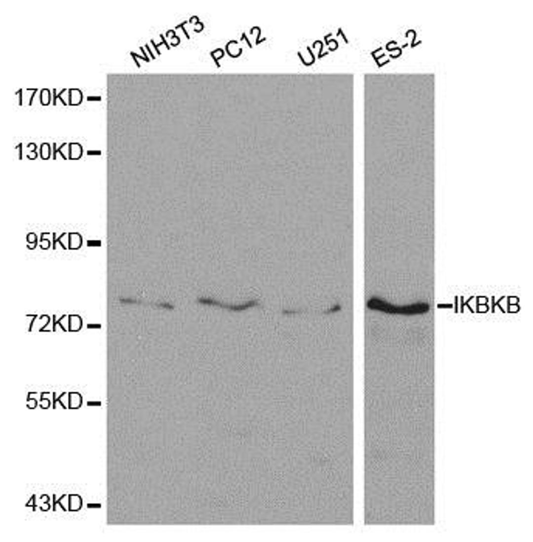 Western blot analysis of extracts of various cell lines using IKBKB antibody