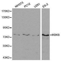 Western blot analysis of extracts of various cell lines using IKBKB antibody