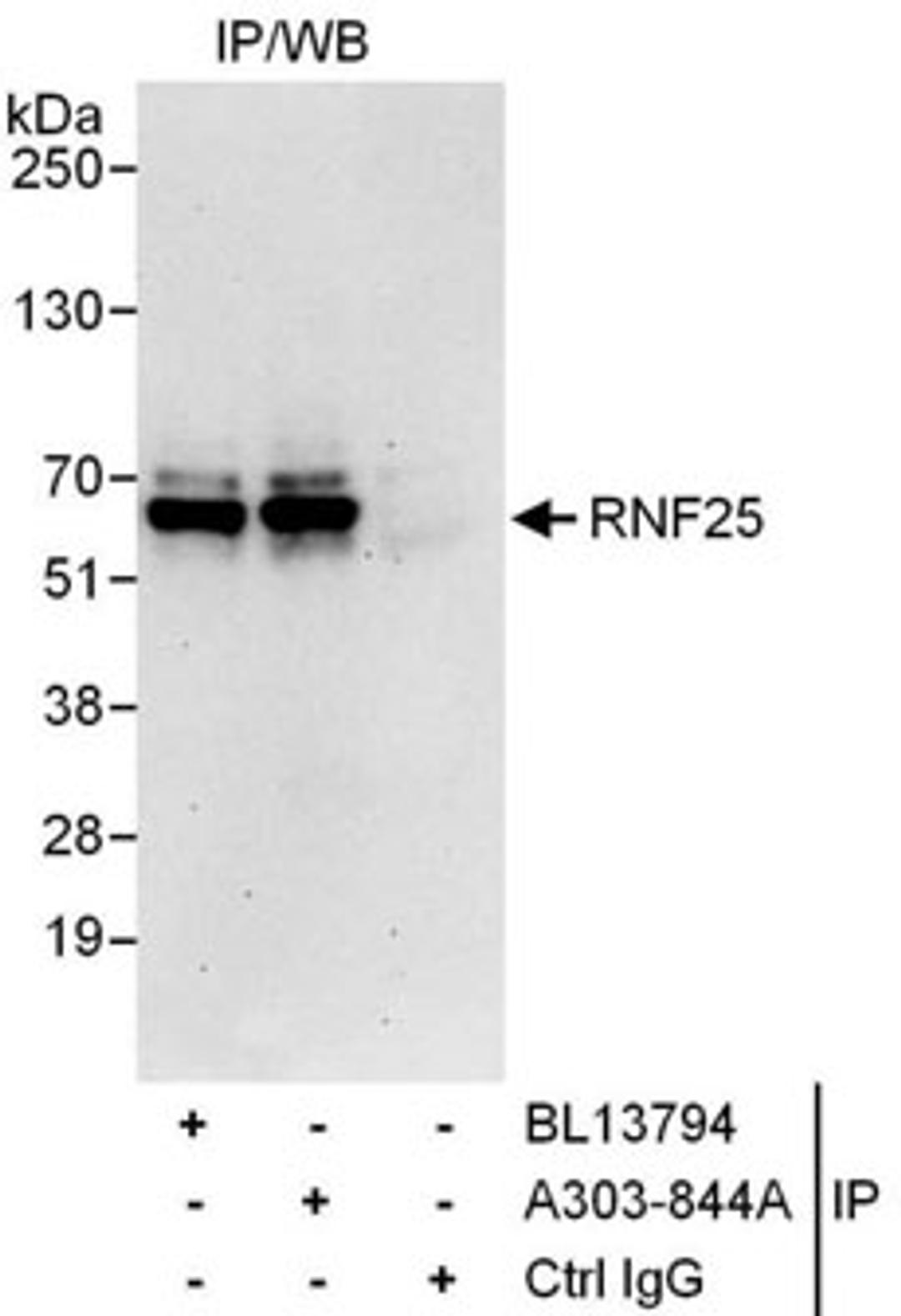 Detection of human RNF25 by western blot of immunoprecipitates.