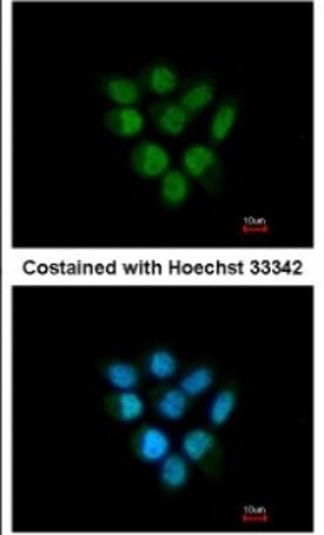 Immunocytochemistry/Immunofluorescence: F-box protein 43 Antibody [NBP1-31473] - Paraformaldehyde-fixed A431, using antibody at 1:200 dilution.