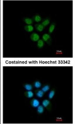 Immunocytochemistry/Immunofluorescence: F-box protein 43 Antibody [NBP1-31473] - Paraformaldehyde-fixed A431, using antibody at 1:200 dilution.