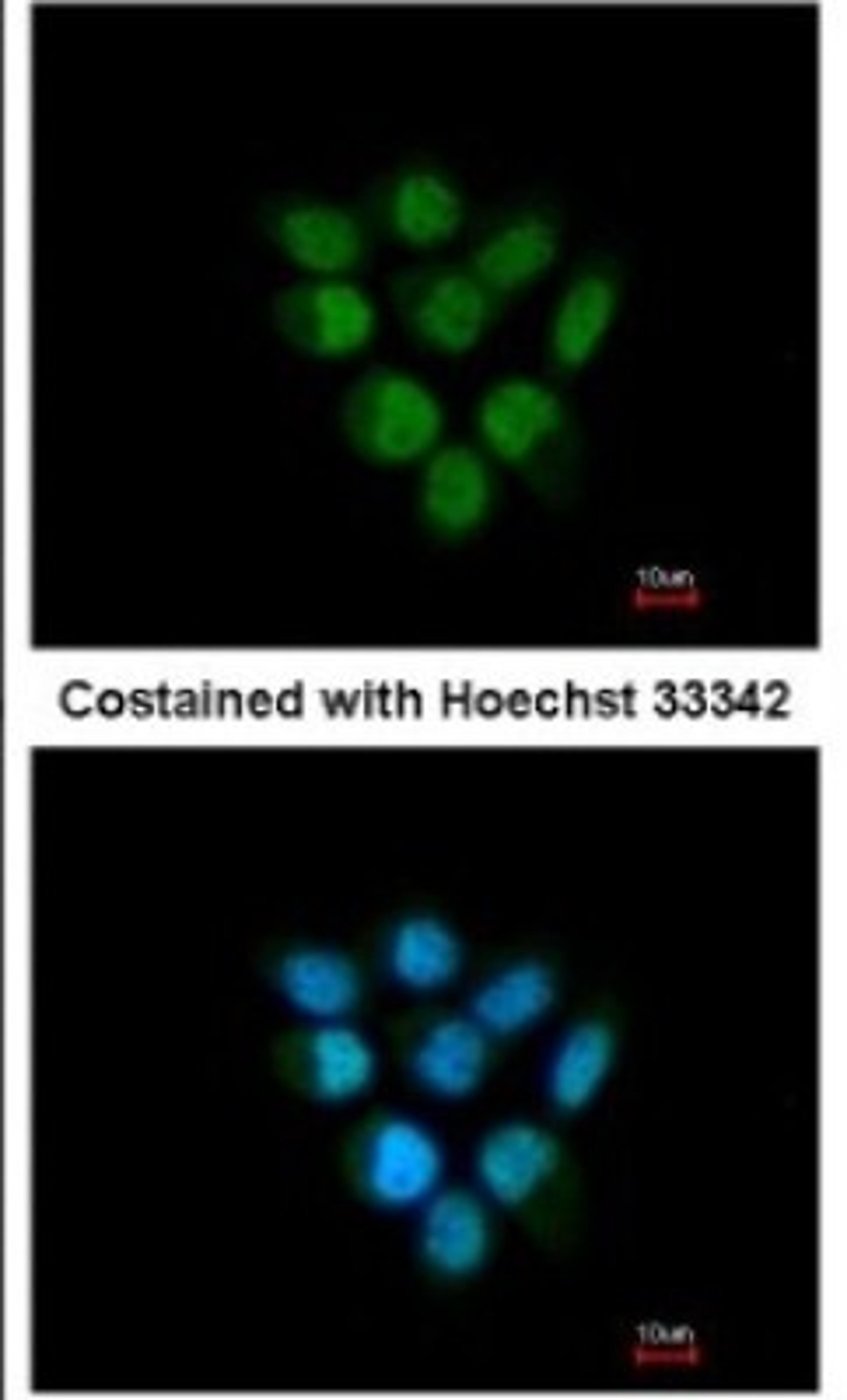 Immunocytochemistry/Immunofluorescence: F-box protein 43 Antibody [NBP1-31473] - Paraformaldehyde-fixed A431, using antibody at 1:200 dilution.