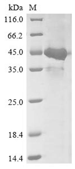 (Tris-Glycine gel) Discontinuous SDS-PAGE (reduced) with 5% enrichment gel and 15% separation gel.