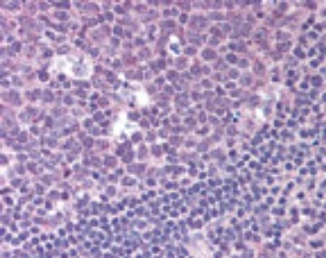 Immunohistochemistry-Paraffin: CXCR7 Antibody [NBP2-24779] - Analysis of RDC1 in paraffin-embedded formalin-fixed human tonsil tissue using this antibody at 10 ug/ml.