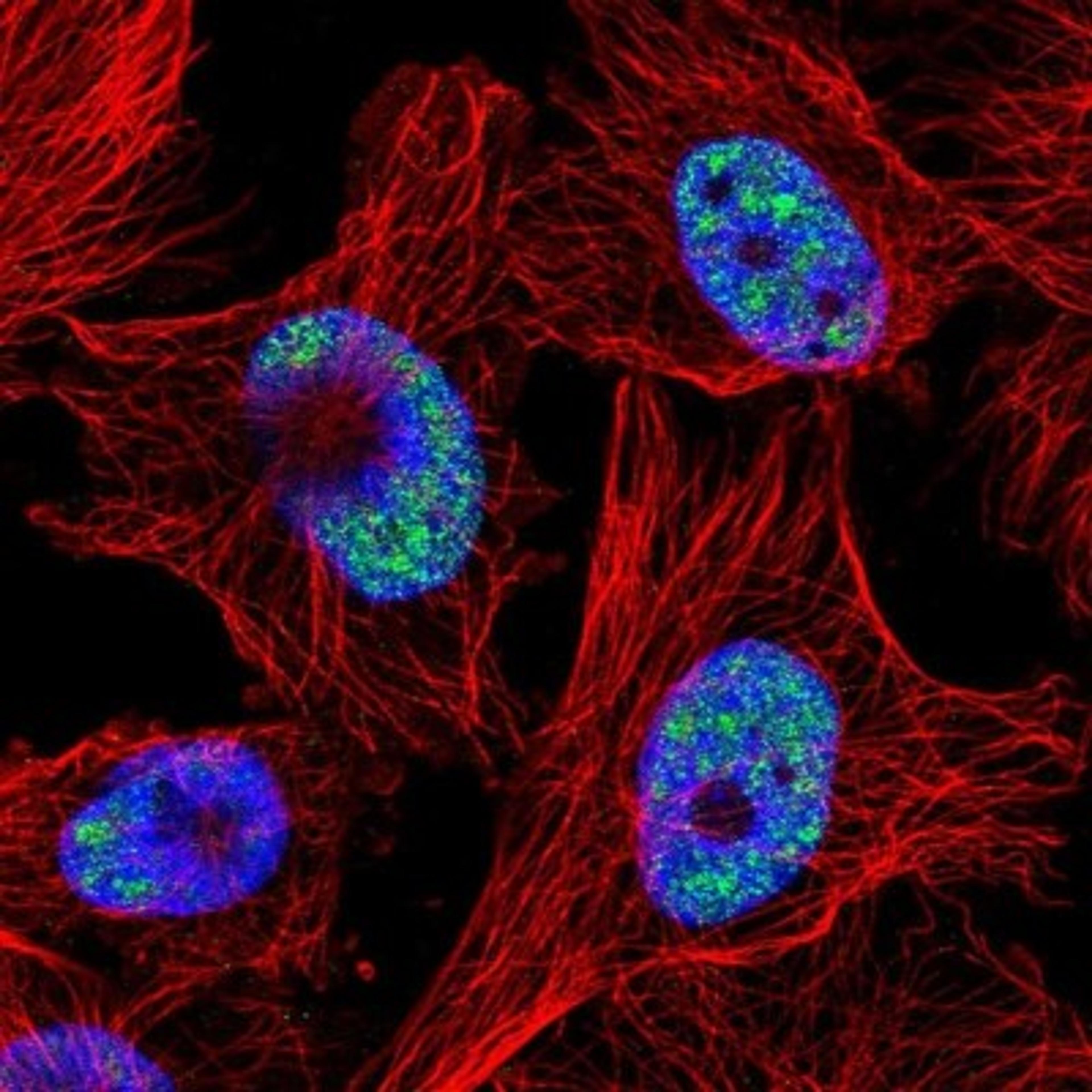 Immunocytochemistry/Immunofluorescence: C6orf226 Antibody [NBP1-91739] - Staining of human cell line U-251 MG shows positivity in nucleus but not nucleoli.