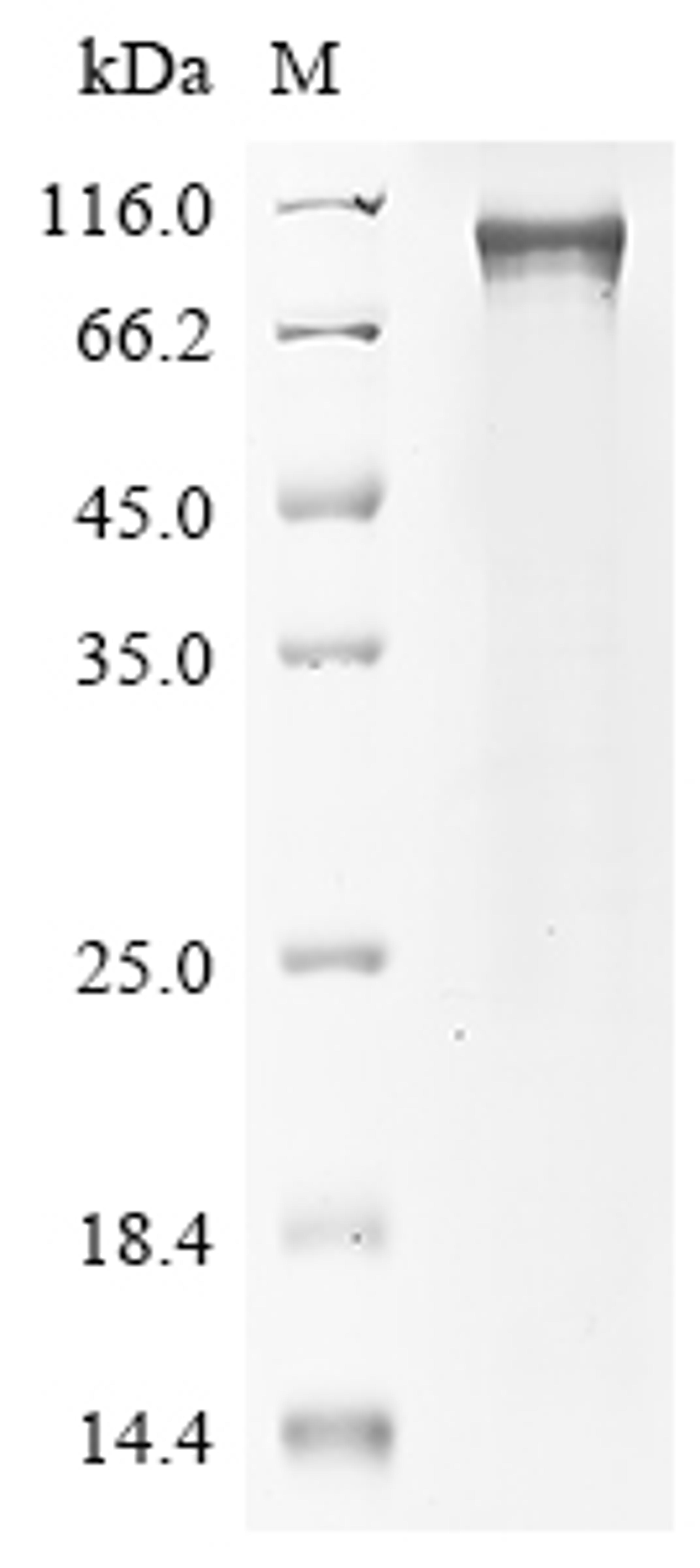 (Tris-Glycine gel) Discontinuous SDS-PAGE (reduced) with 5% enrichment gel and 15% separation gel.