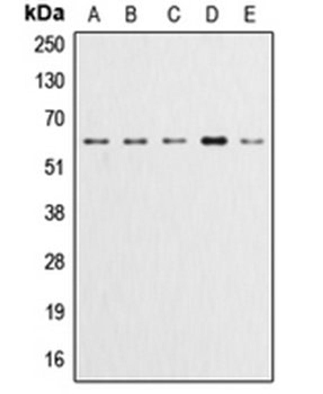 Western blot analysis of HeLa (Lane 1), A549 (Lane 2), LOVO (Lane 3), HepG2 (Lane 4), NIH3T3 (Lane 5) whole cell lysates using AKT1 antibody