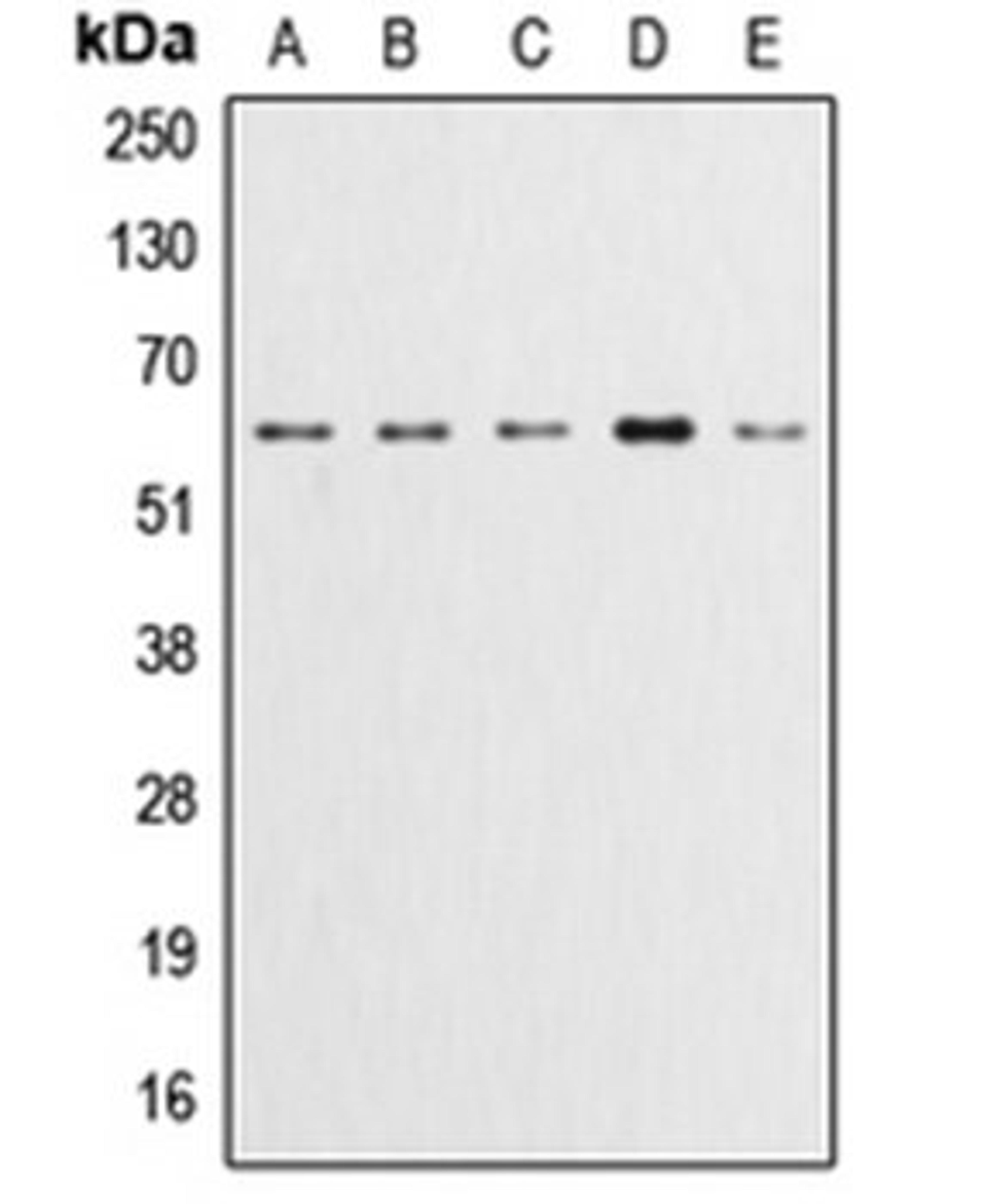 Western blot analysis of HeLa (Lane 1), A549 (Lane 2), LOVO (Lane 3), HepG2 (Lane 4), NIH3T3 (Lane 5) whole cell lysates using AKT1 antibody