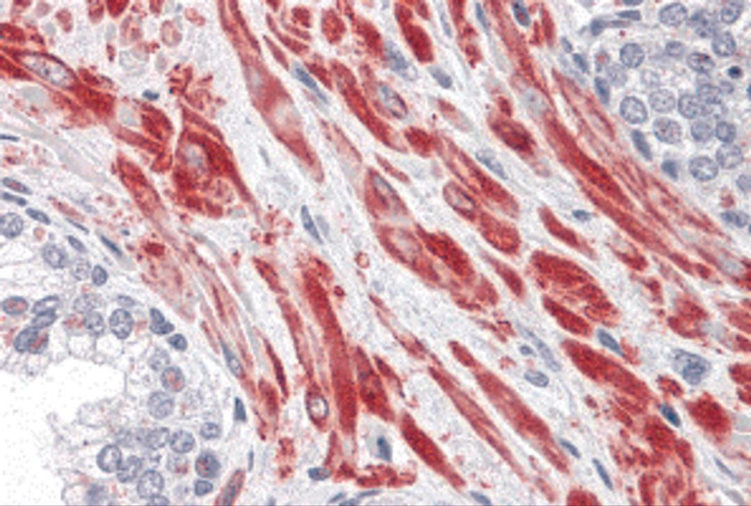 Immunohistochemistry of TBC1D4 in human prostate tissue with TBC1D4 antibody at 10 μg/mL.