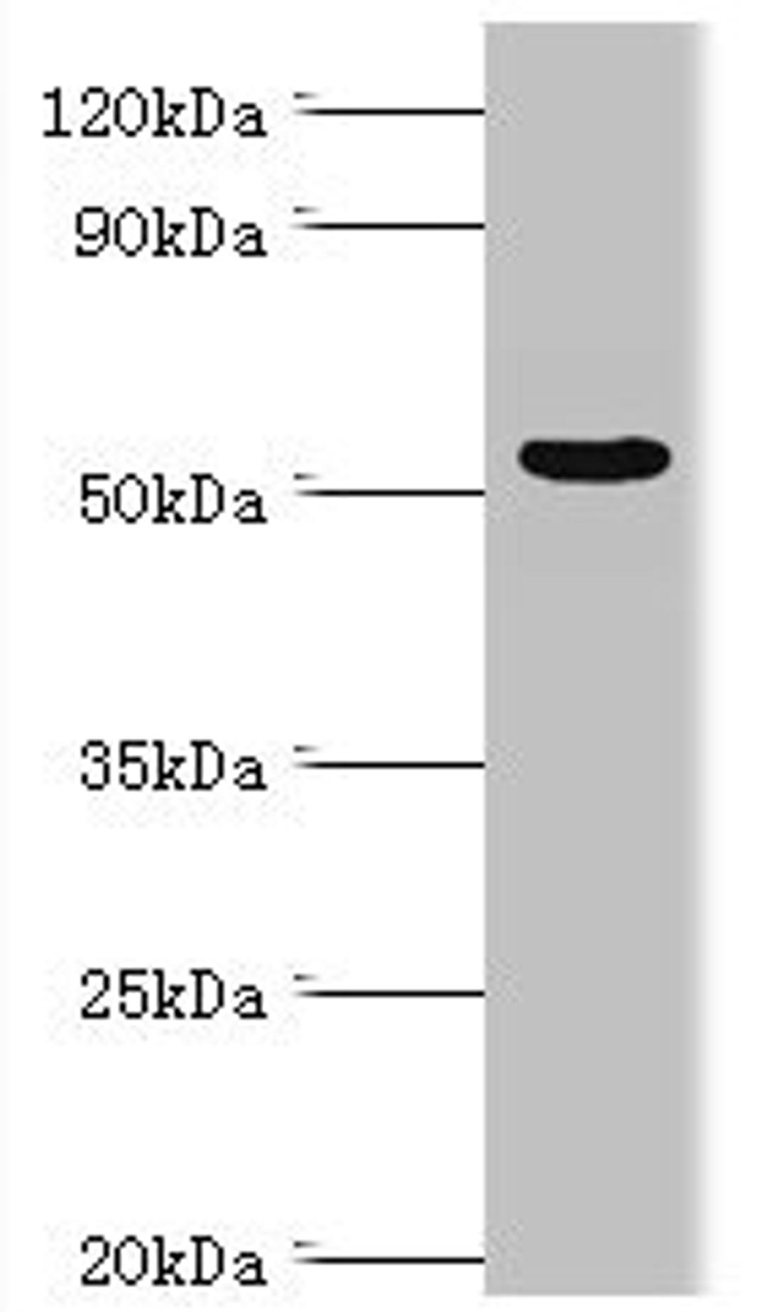 Western blot. All lanes: Carbonic anhydrase 1 antibody at 6ug/ml + Rat brain tissue. Secondary. Goat polyclonal to rabbit IgG at 1/10000 dilution. Predicted band size: 55, 52 kDa. Observed band size: 55 kDa. 