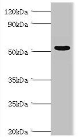 Western blot. All lanes: Carbonic anhydrase 1 antibody at 6ug/ml + Rat brain tissue. Secondary. Goat polyclonal to rabbit IgG at 1/10000 dilution. Predicted band size: 55, 52 kDa. Observed band size: 55 kDa. 