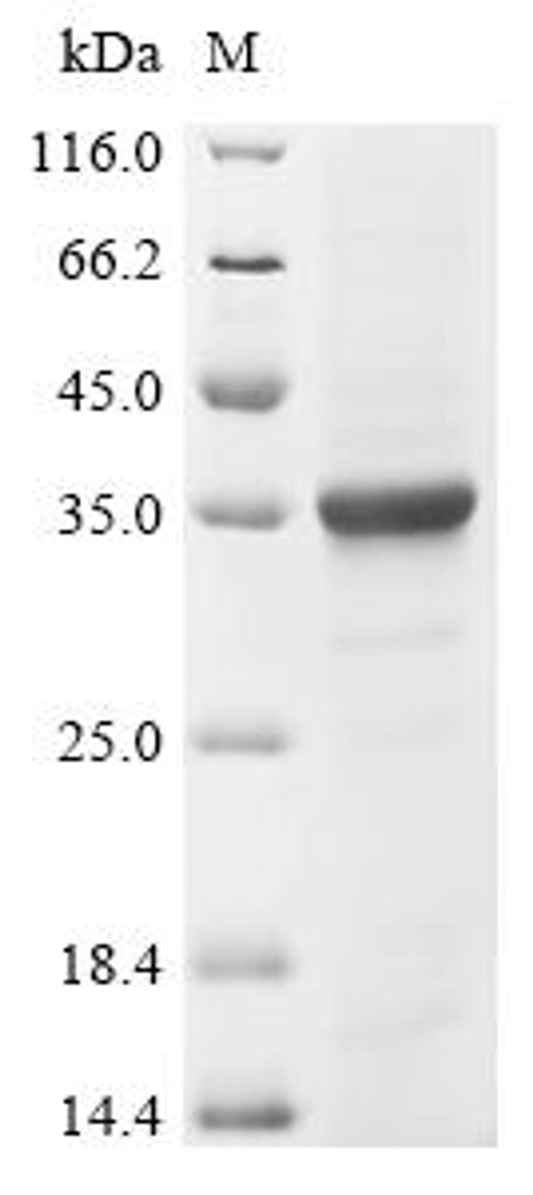 (Tris-Glycine gel) Discontinuous SDS-PAGE (reduced) with 5% enrichment gel and 15% separation gel.