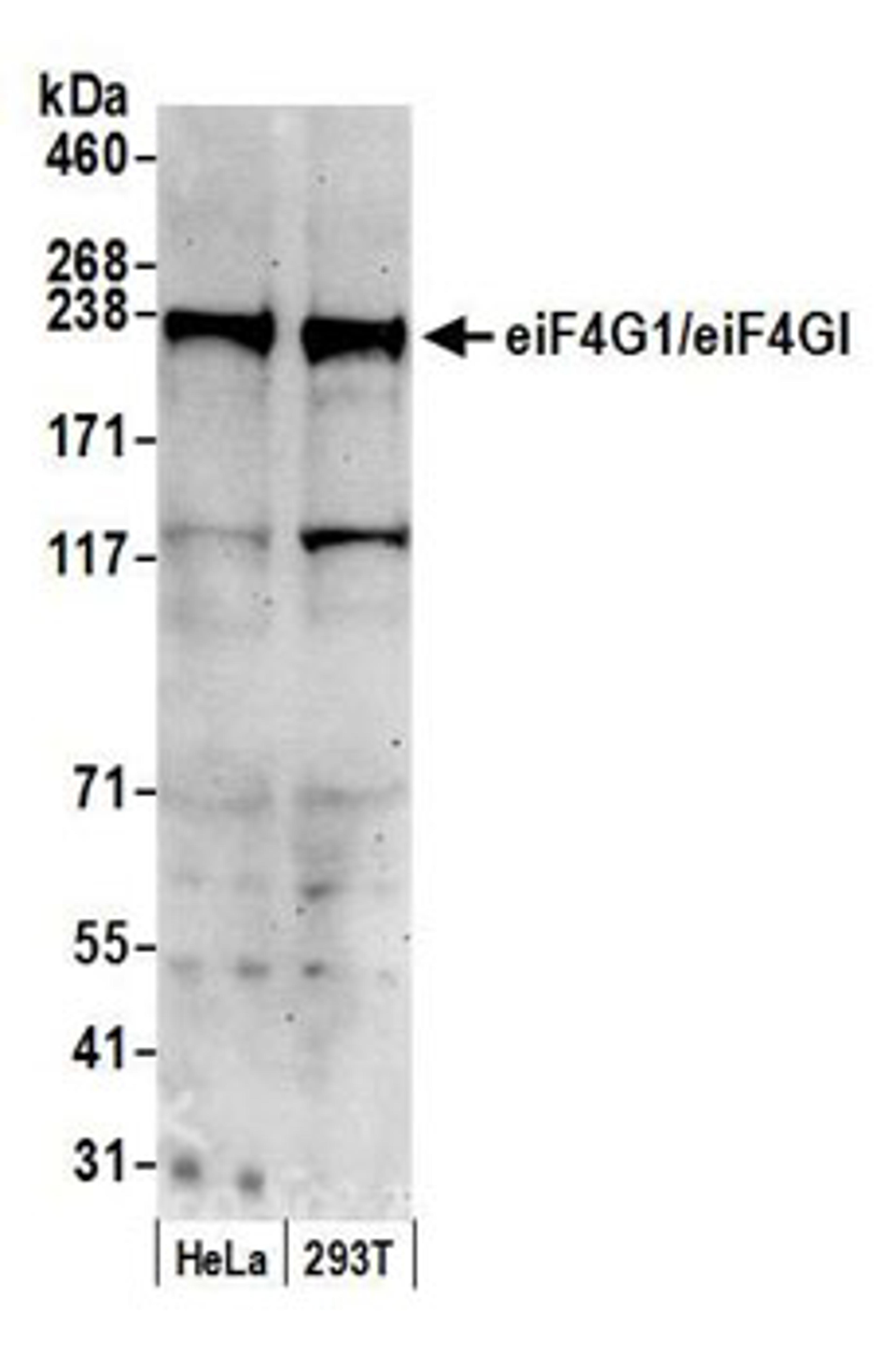 Detection of human eiF4G1/eiF4GI by western blot.